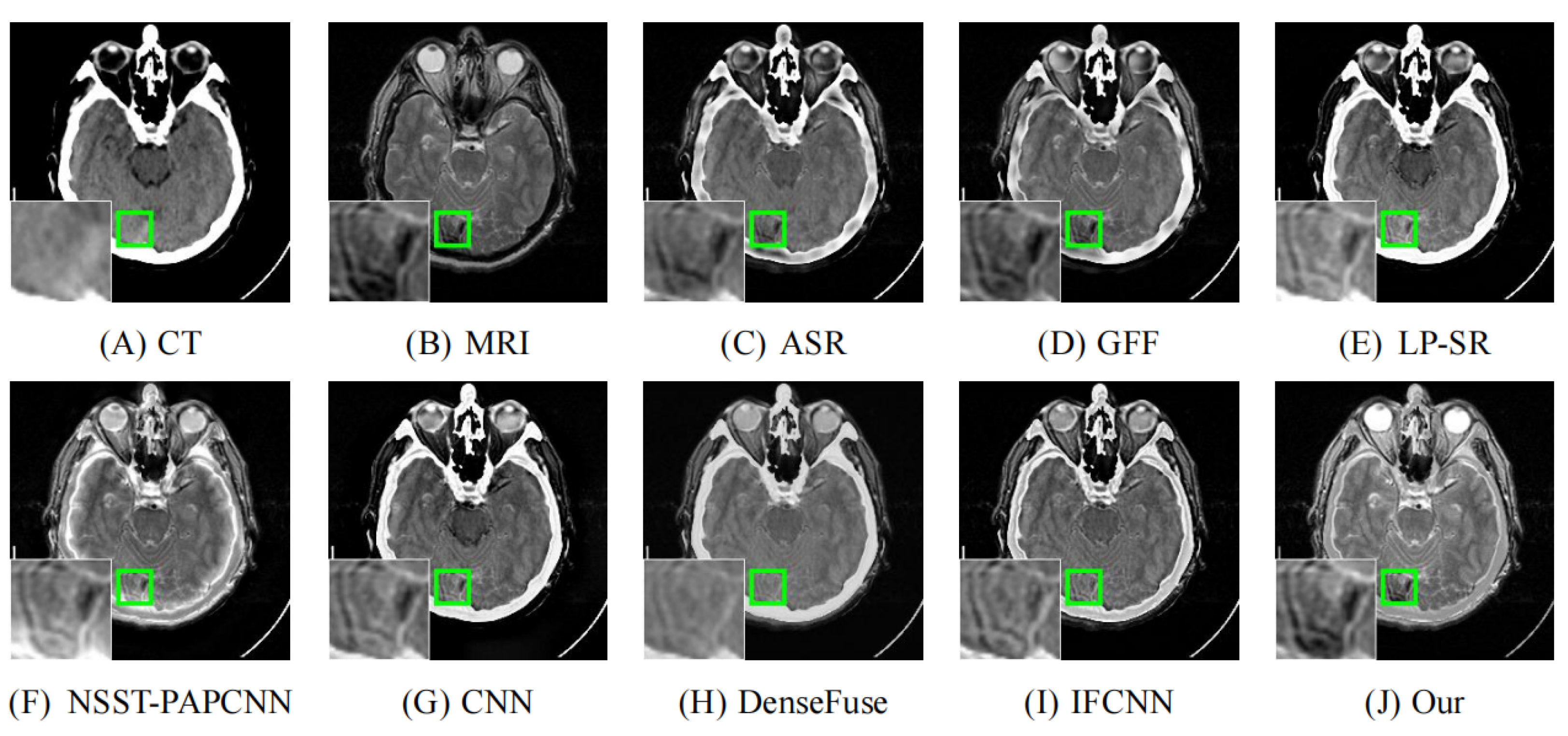 Entropy 24 00843 g008