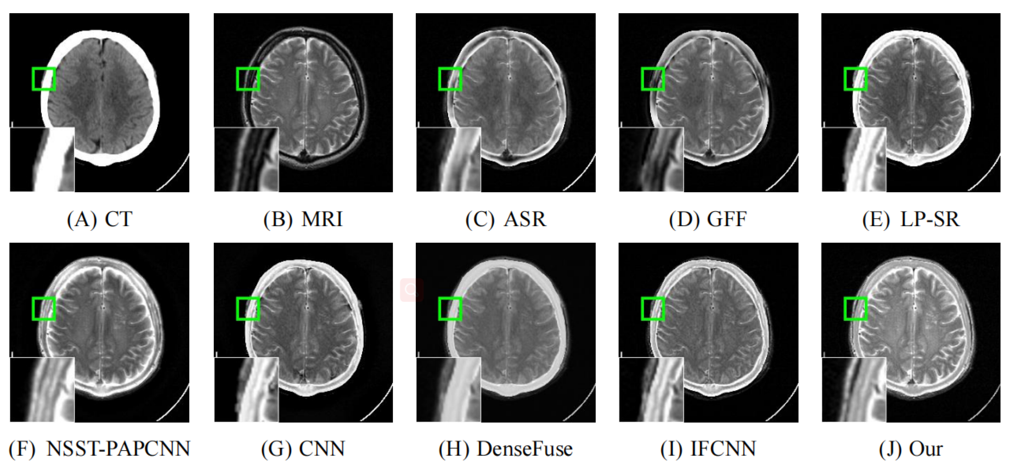 Entropy 24 00843 g009