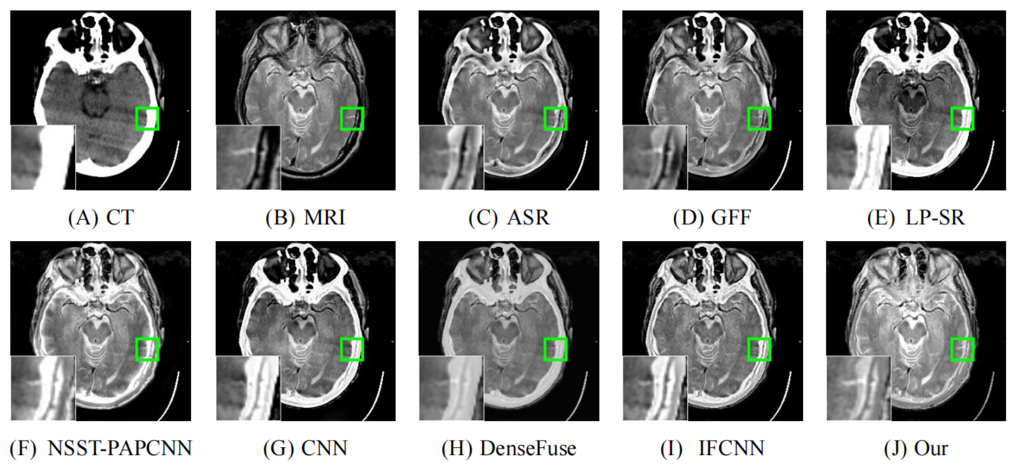 Entropy 24 00843 g010