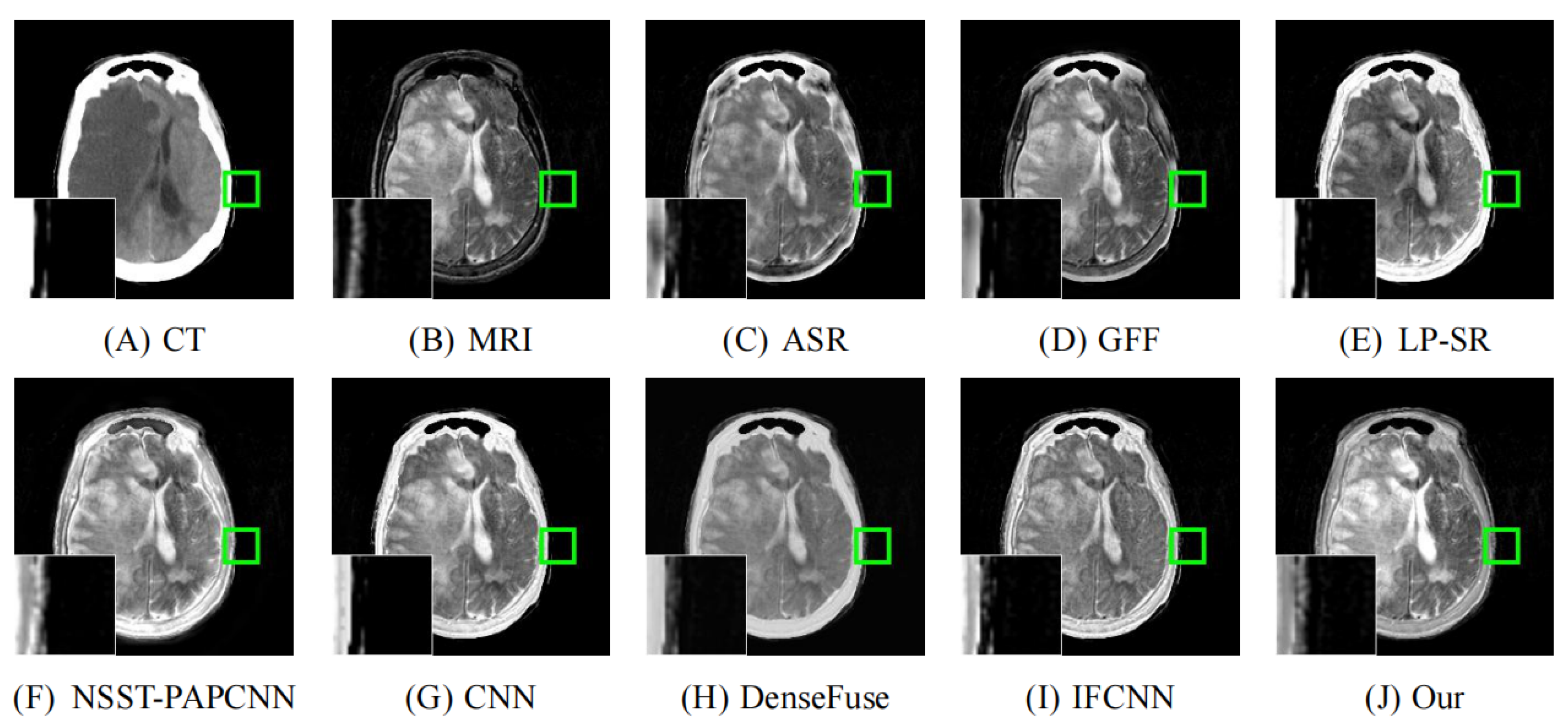 Entropy 24 00843 g011