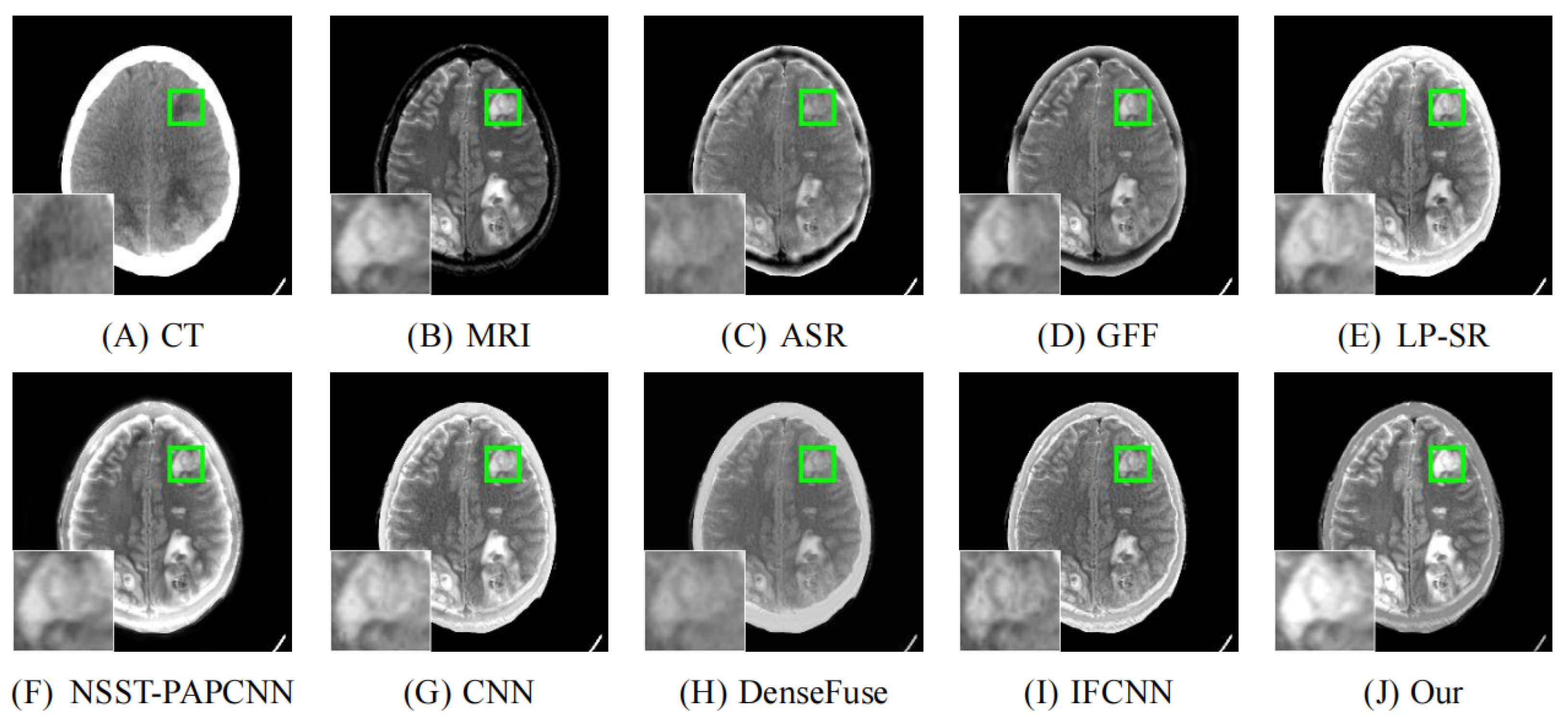 Entropy 24 00843 g012