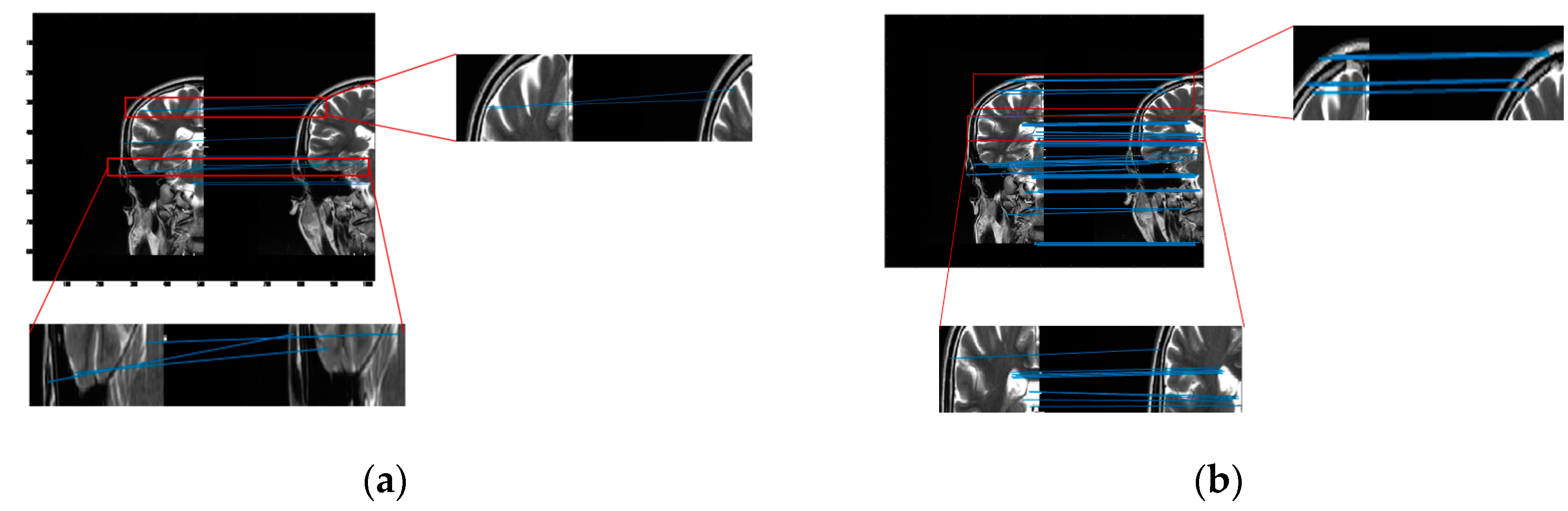 Entropy 24 01199 g004