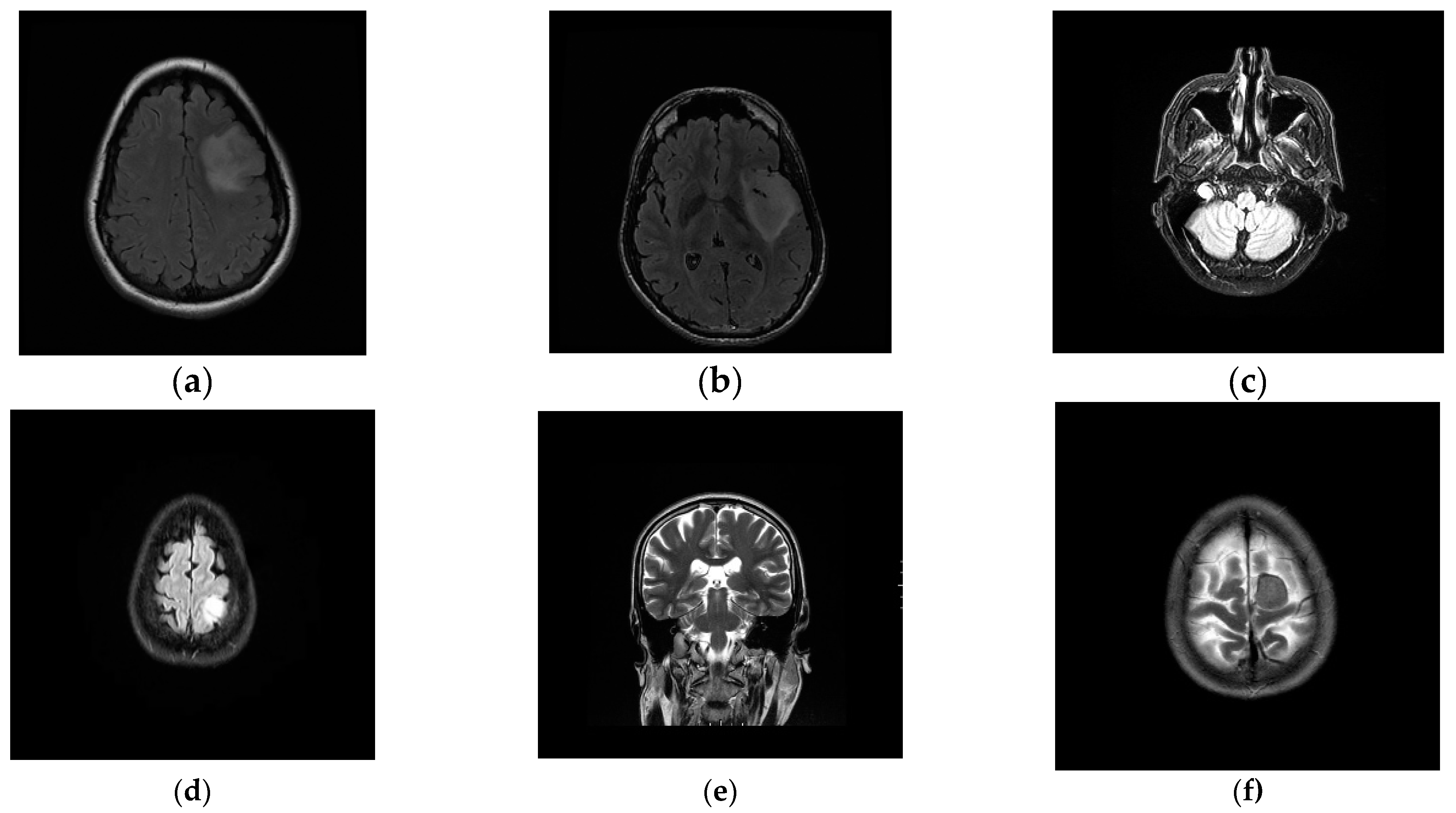 Entropy 24 01199 g008