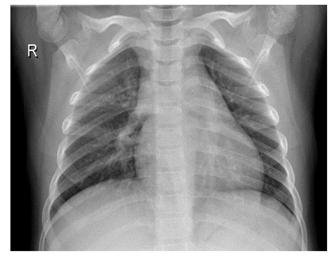 Entropy 24 01434 g006