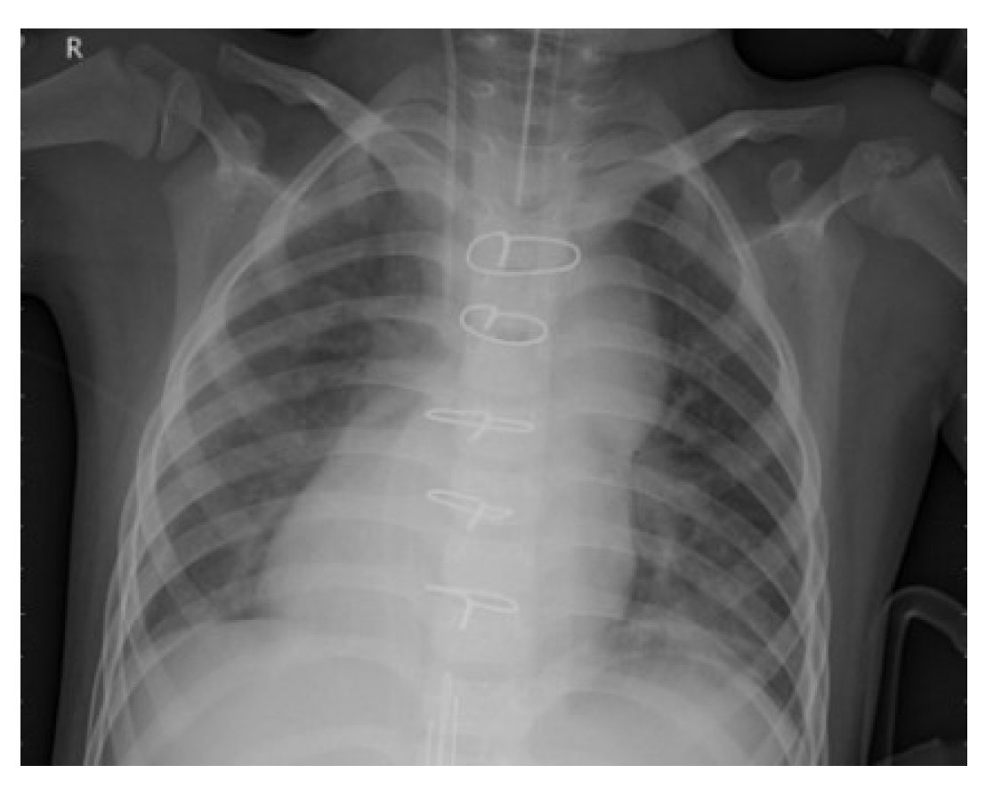 Entropy 24 01434 g007