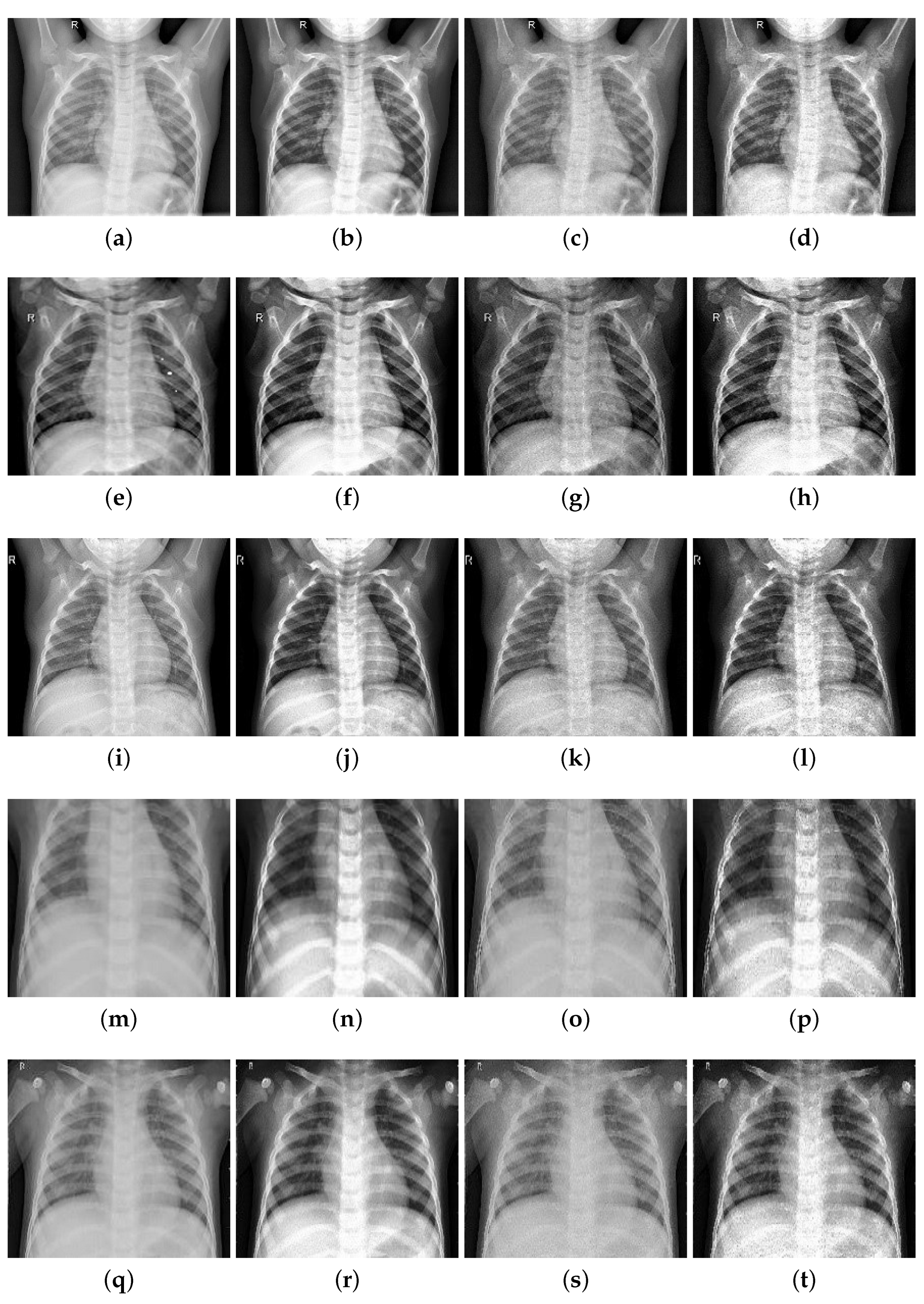 Entropy 24 01434 g008