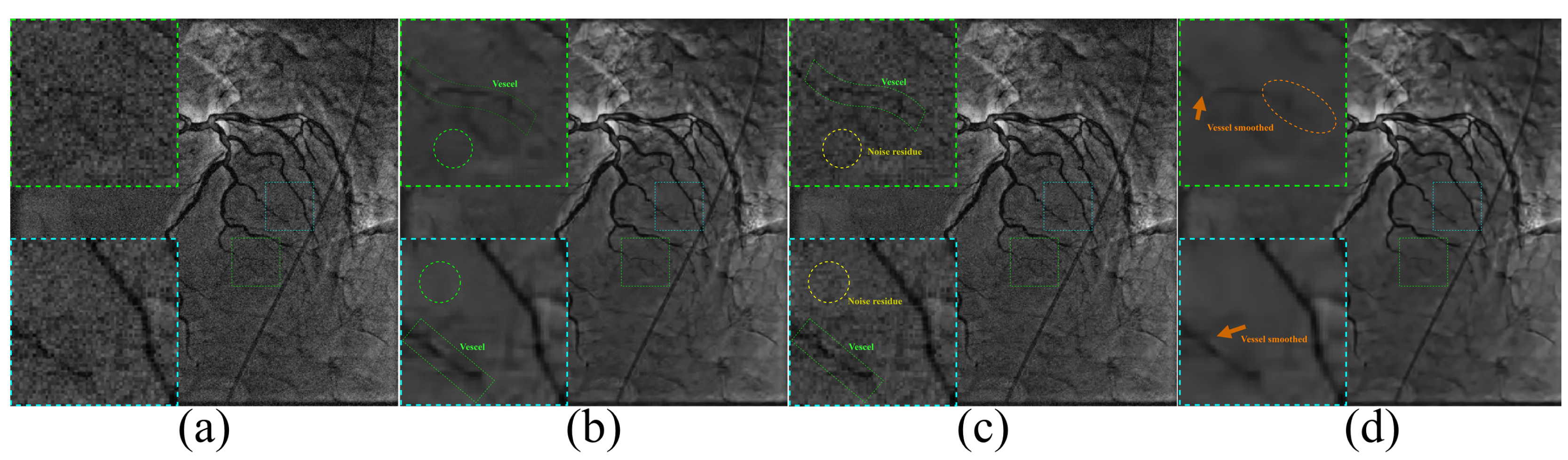 Entropy 24 01518 g011