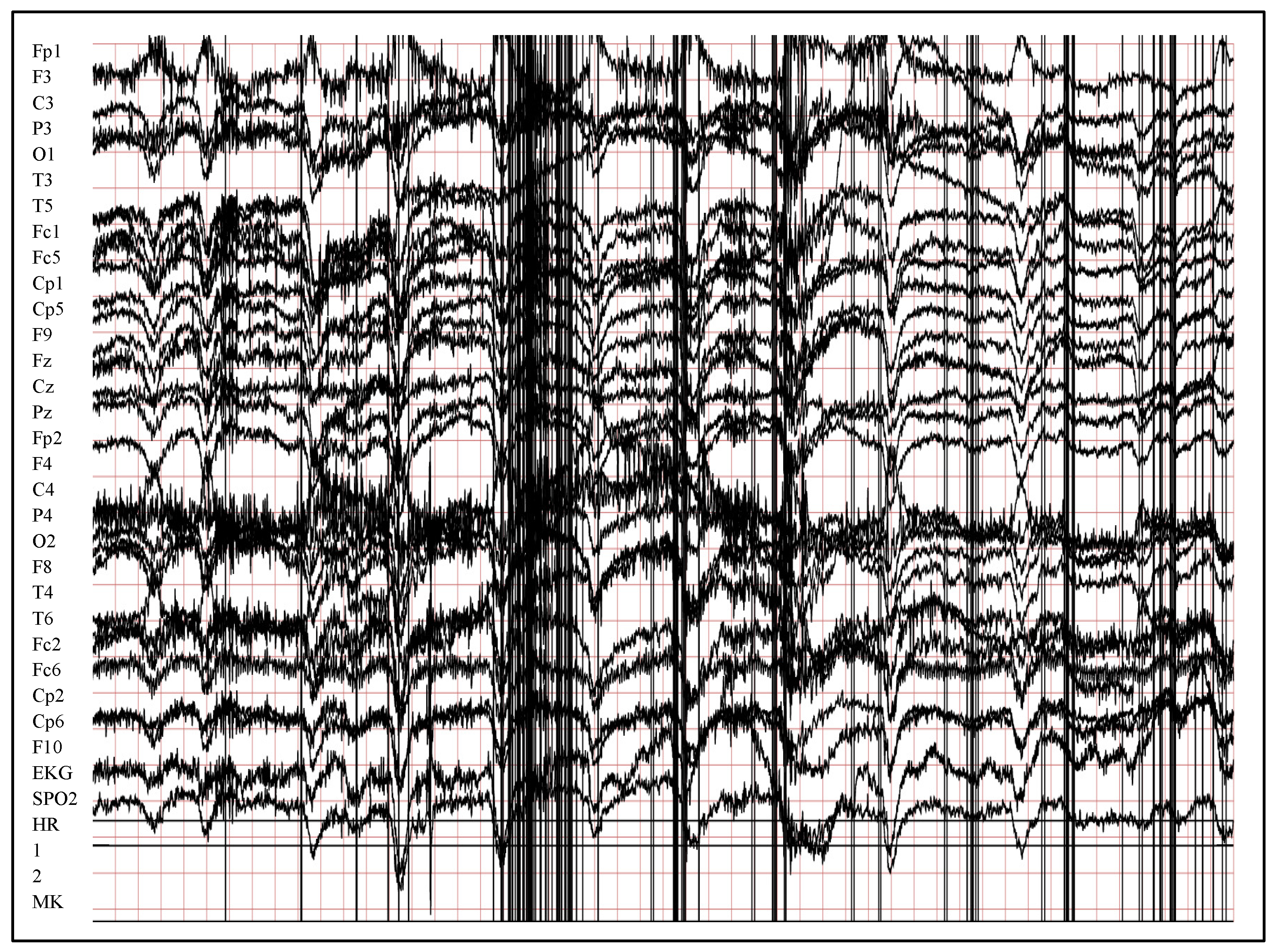 Entropy 24 01641 g004