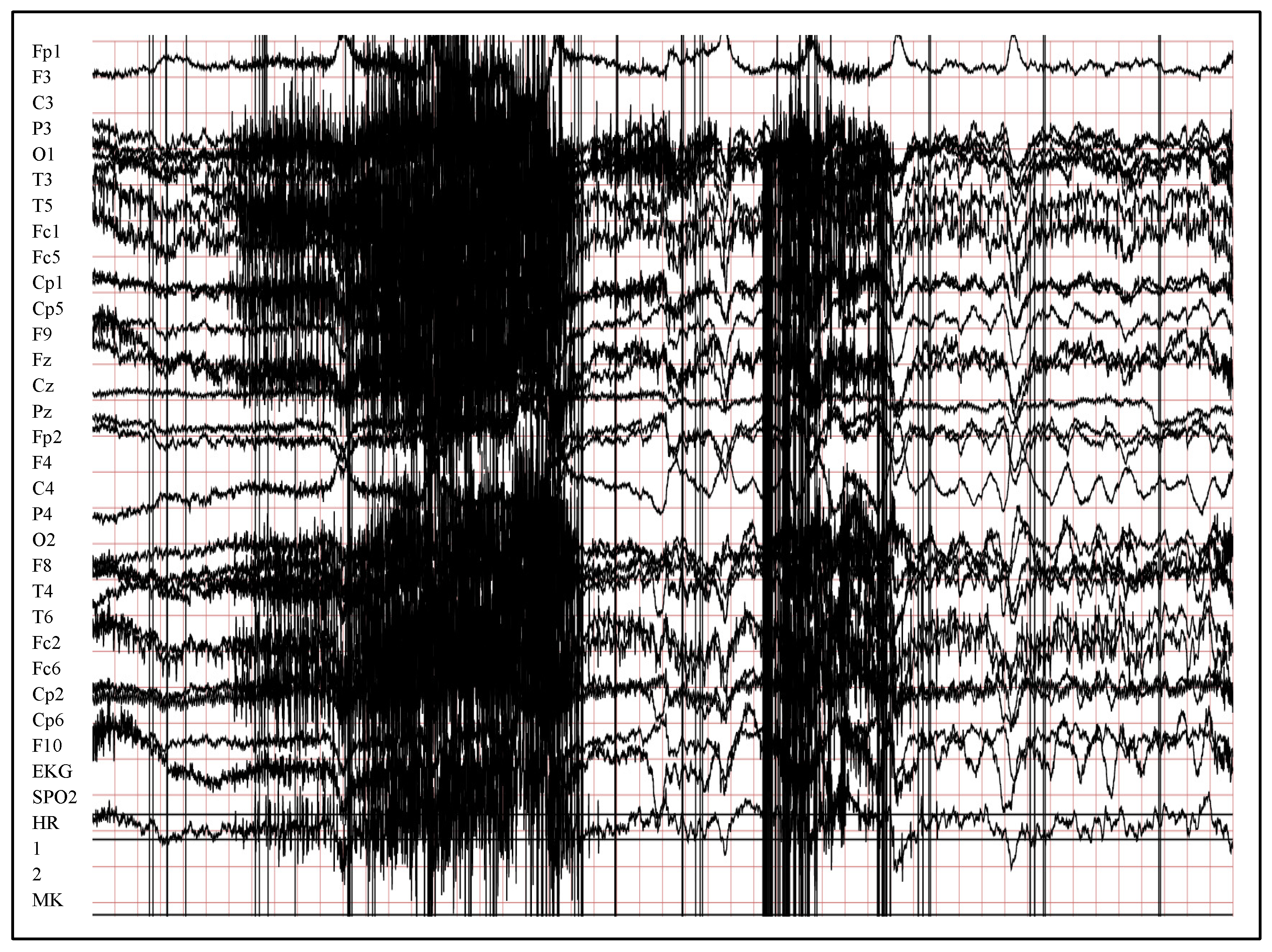 Entropy 24 01641 g005