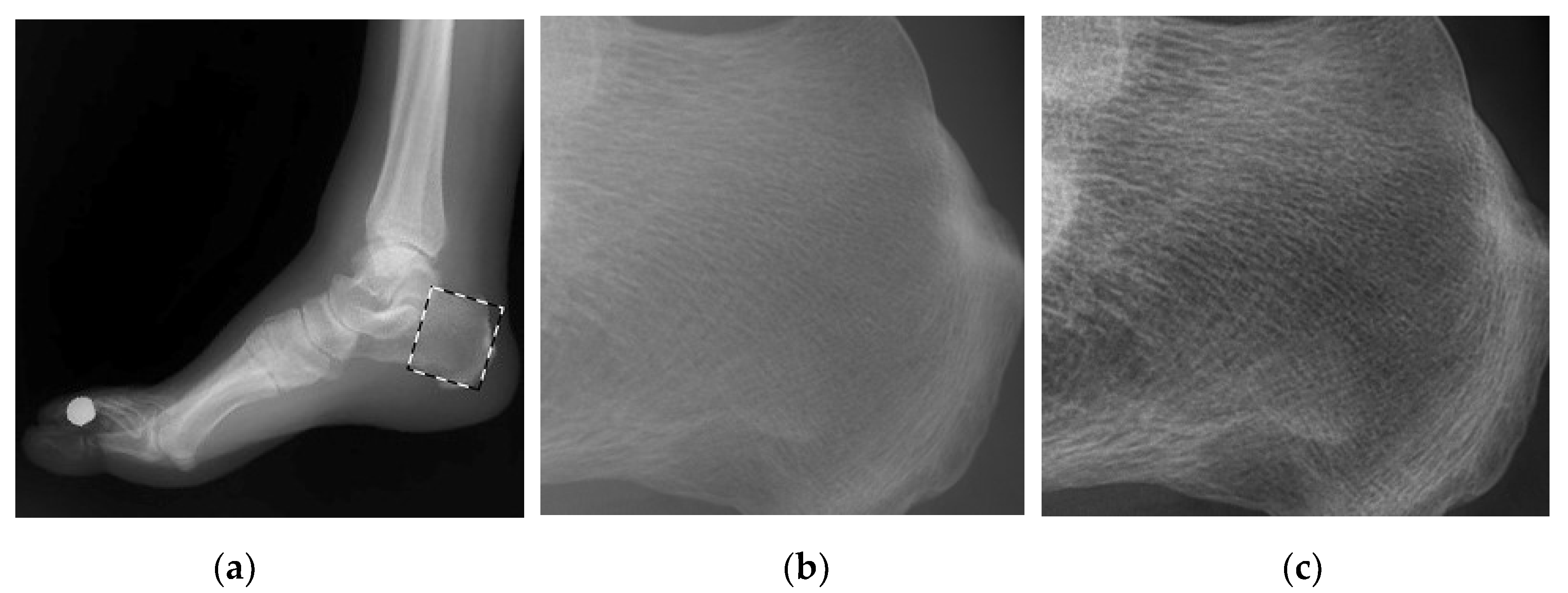 Entropy 24 01754 g004