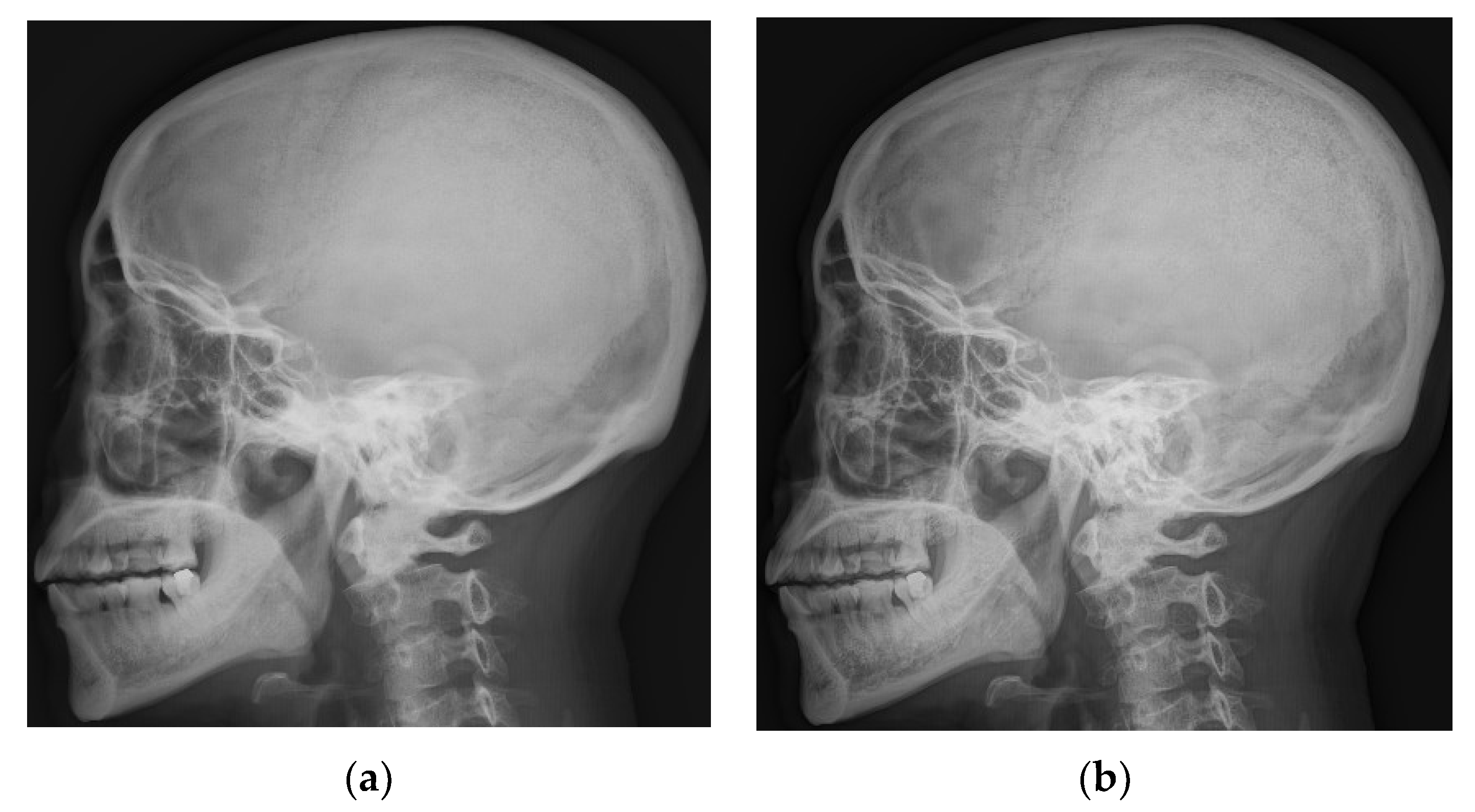 Entropy 24 01754 g009