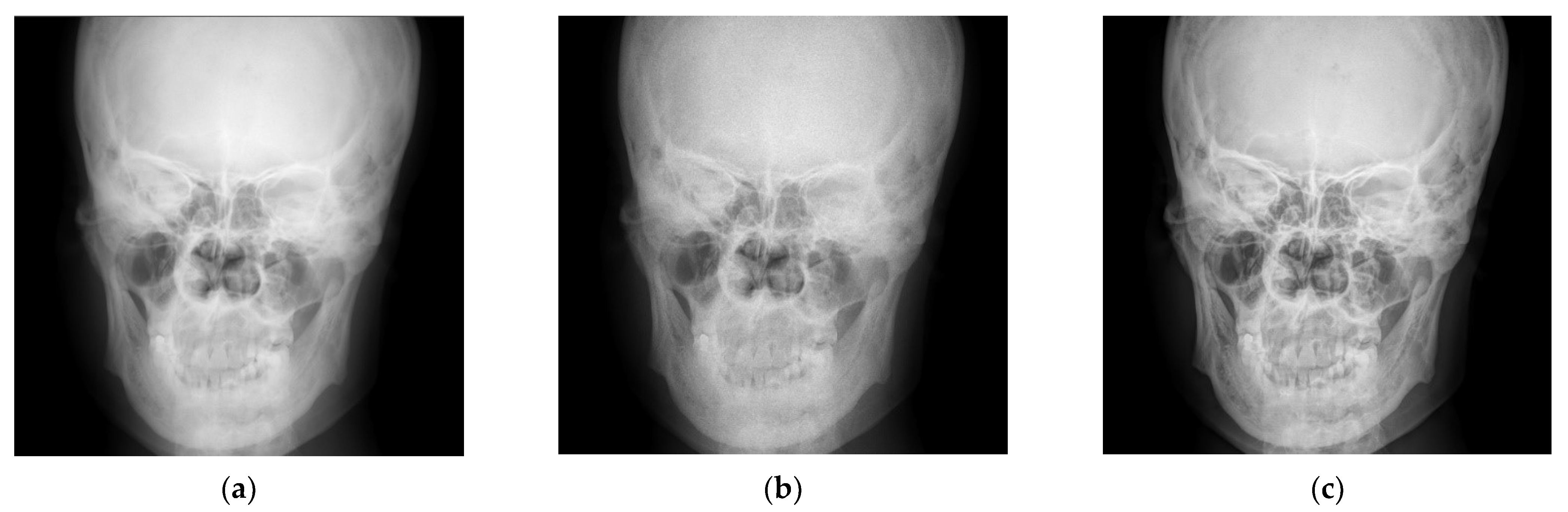 Entropy 24 01754 g010