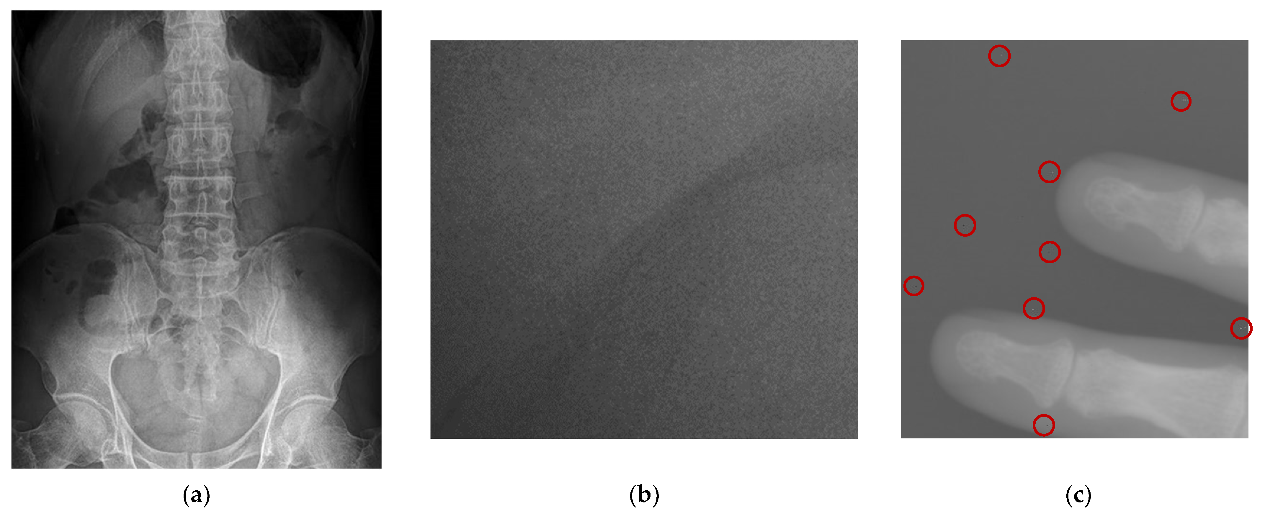 Entropy 24 01754 g011