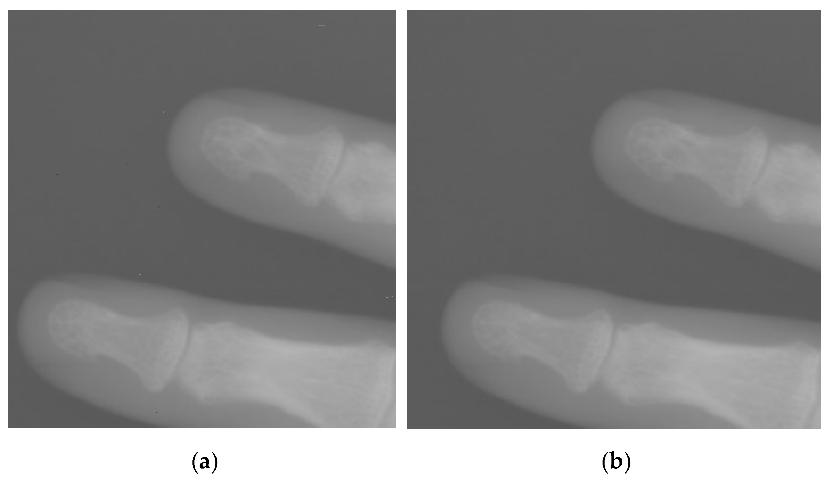 Entropy 24 01754 g012