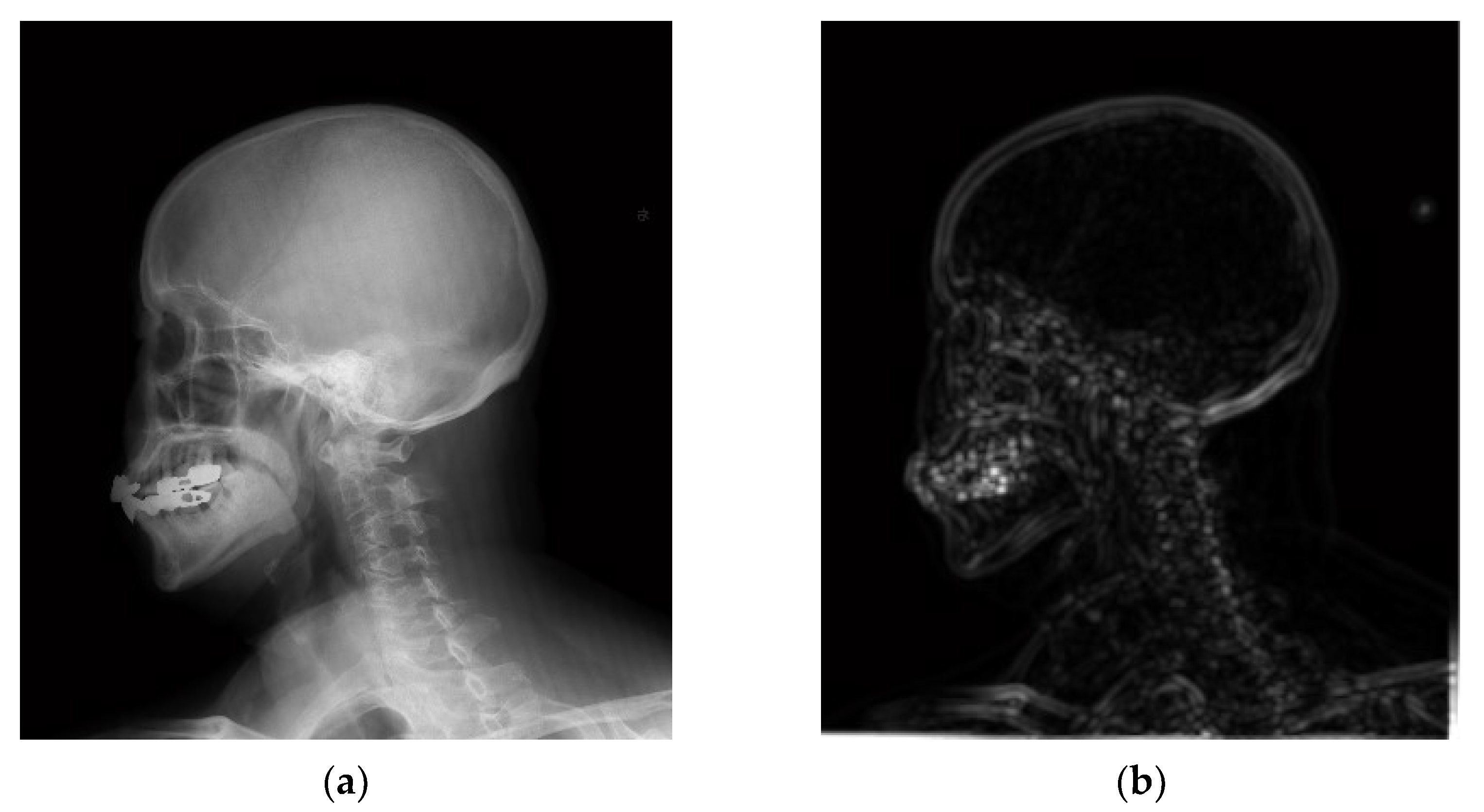 Entropy 24 01754 g013