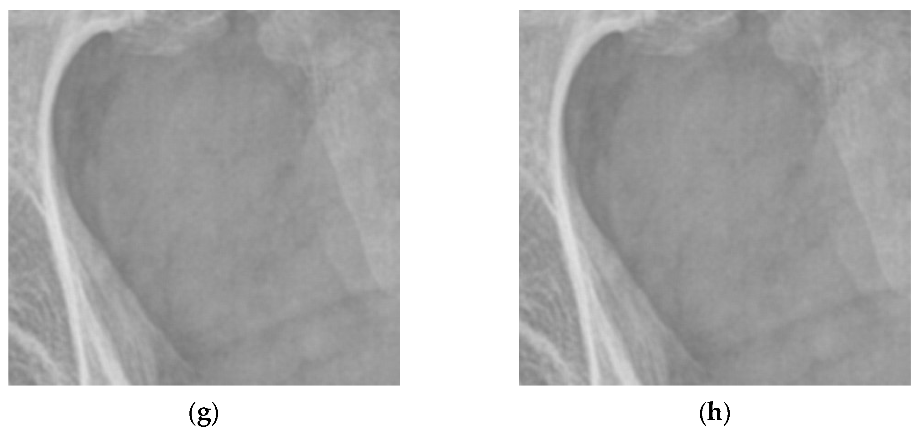 Entropy 24 01754 g015b