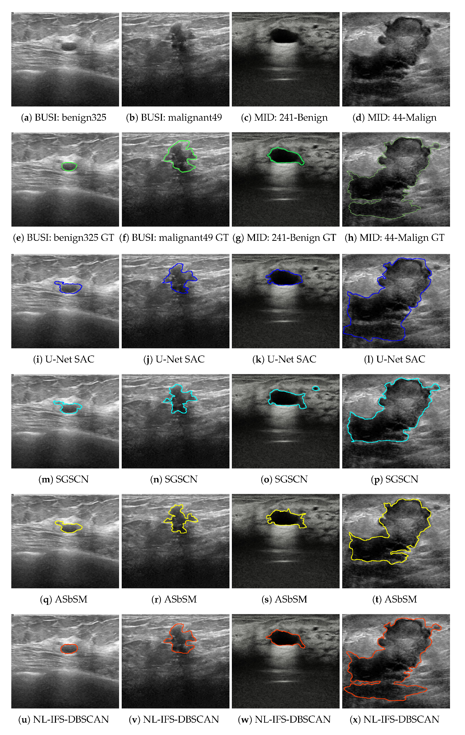 Entropy 24 01775 g004