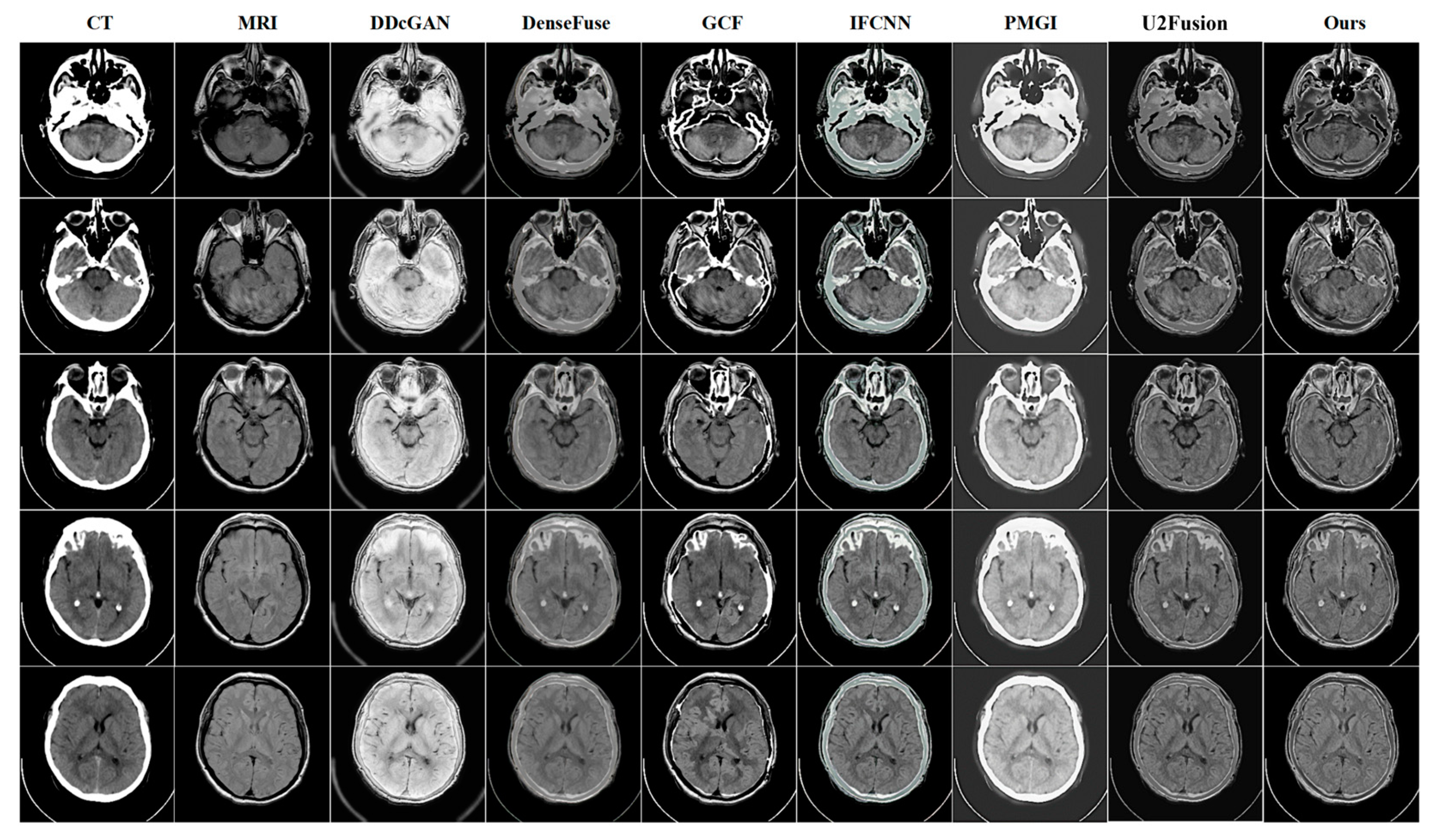 Entropy 24 01823 g003