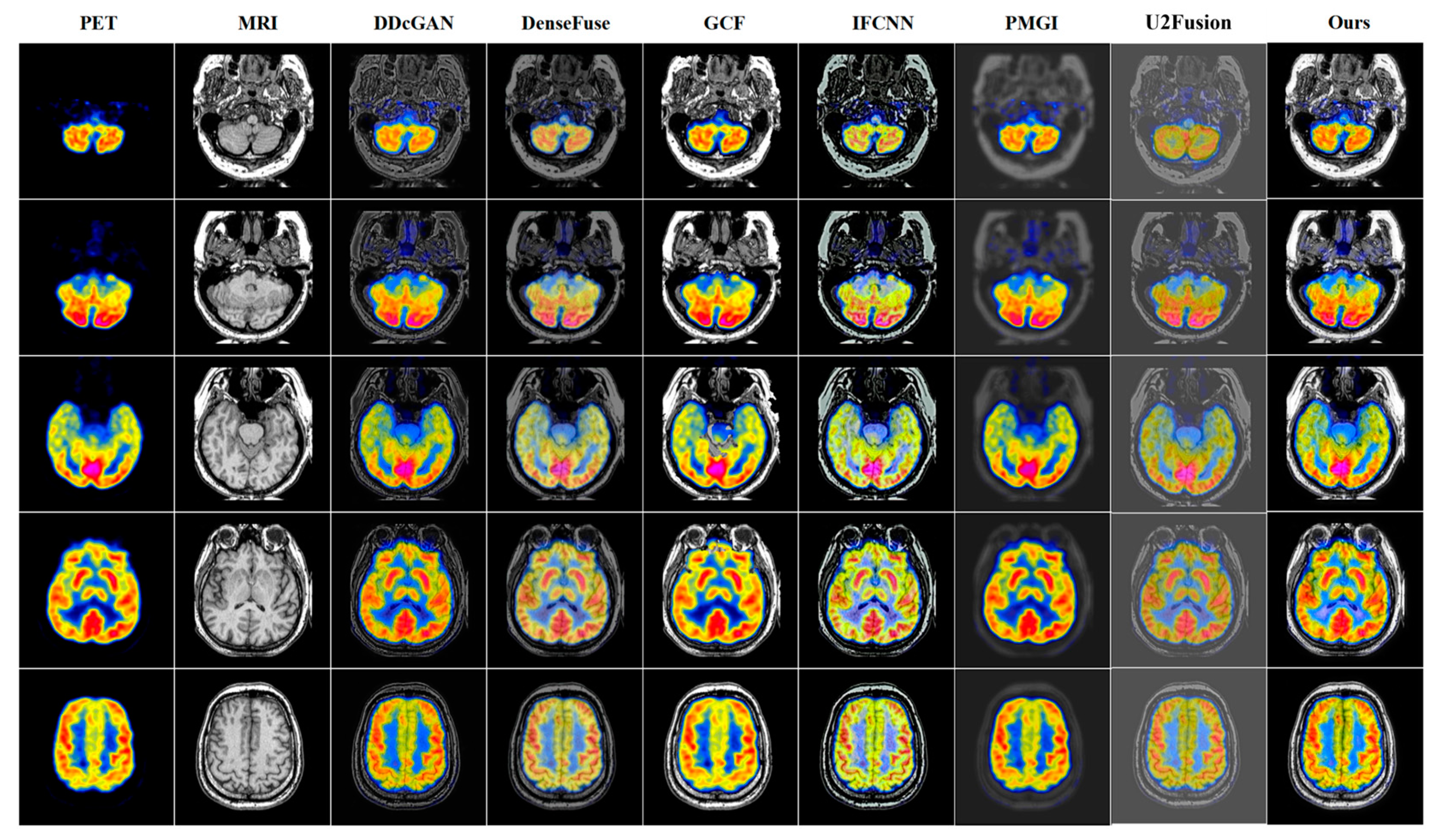 Entropy 24 01823 g004