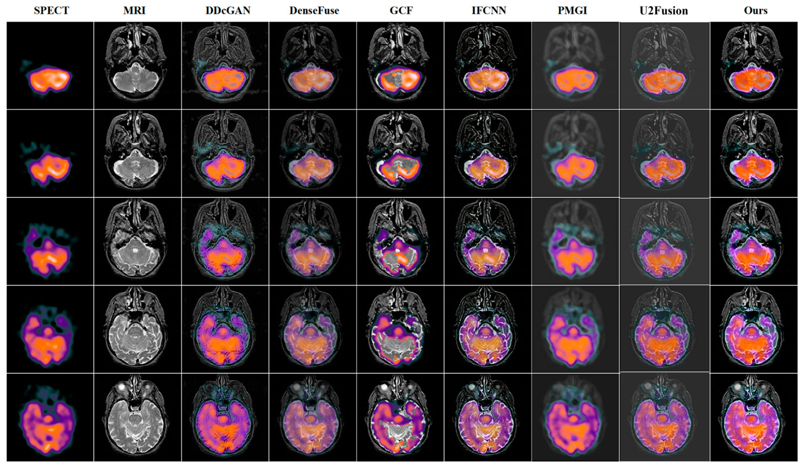 Entropy 24 01823 g005