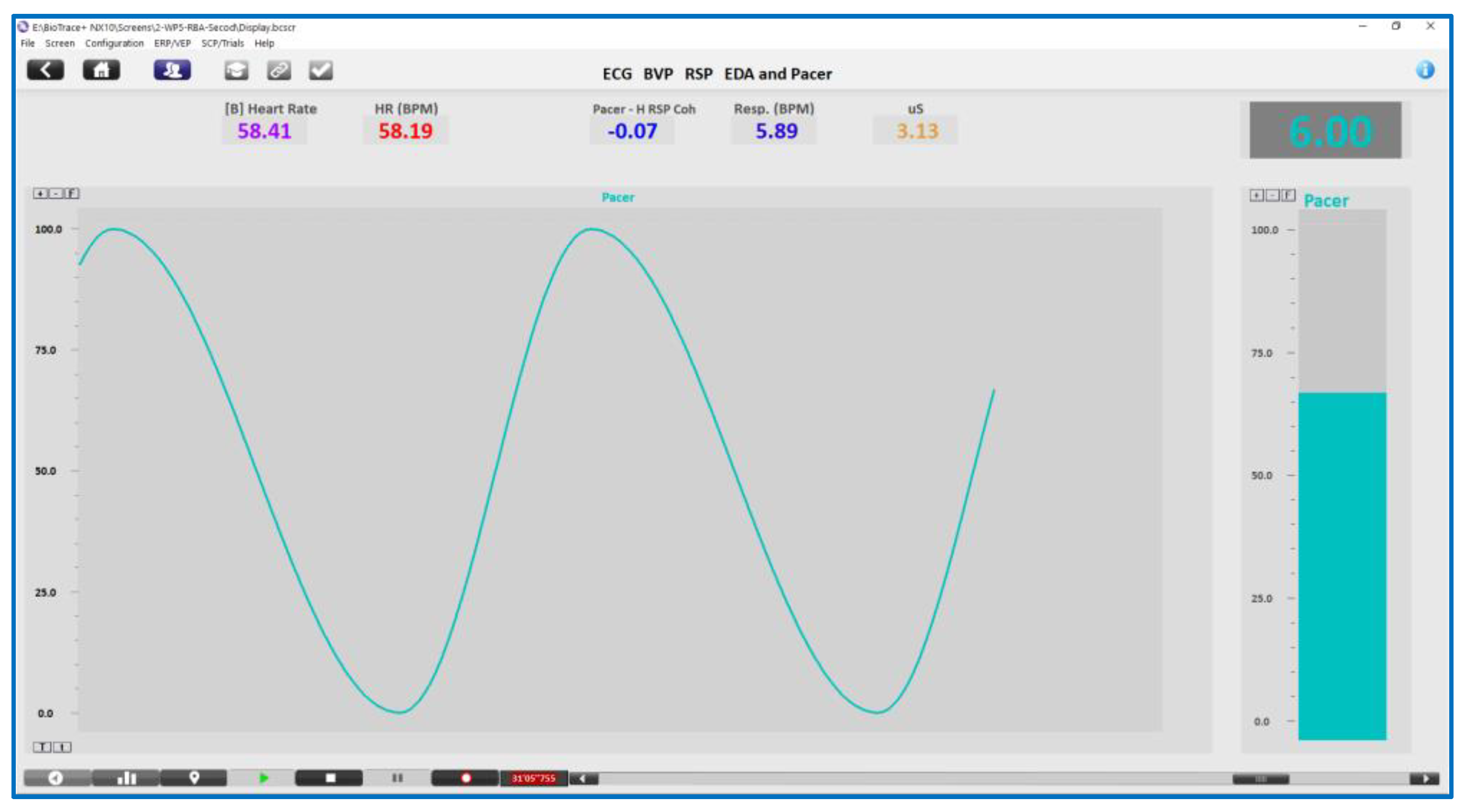 Entropy 25 00301 g002