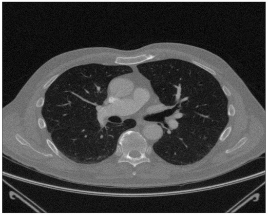 Entropy 25 00524 g0a1