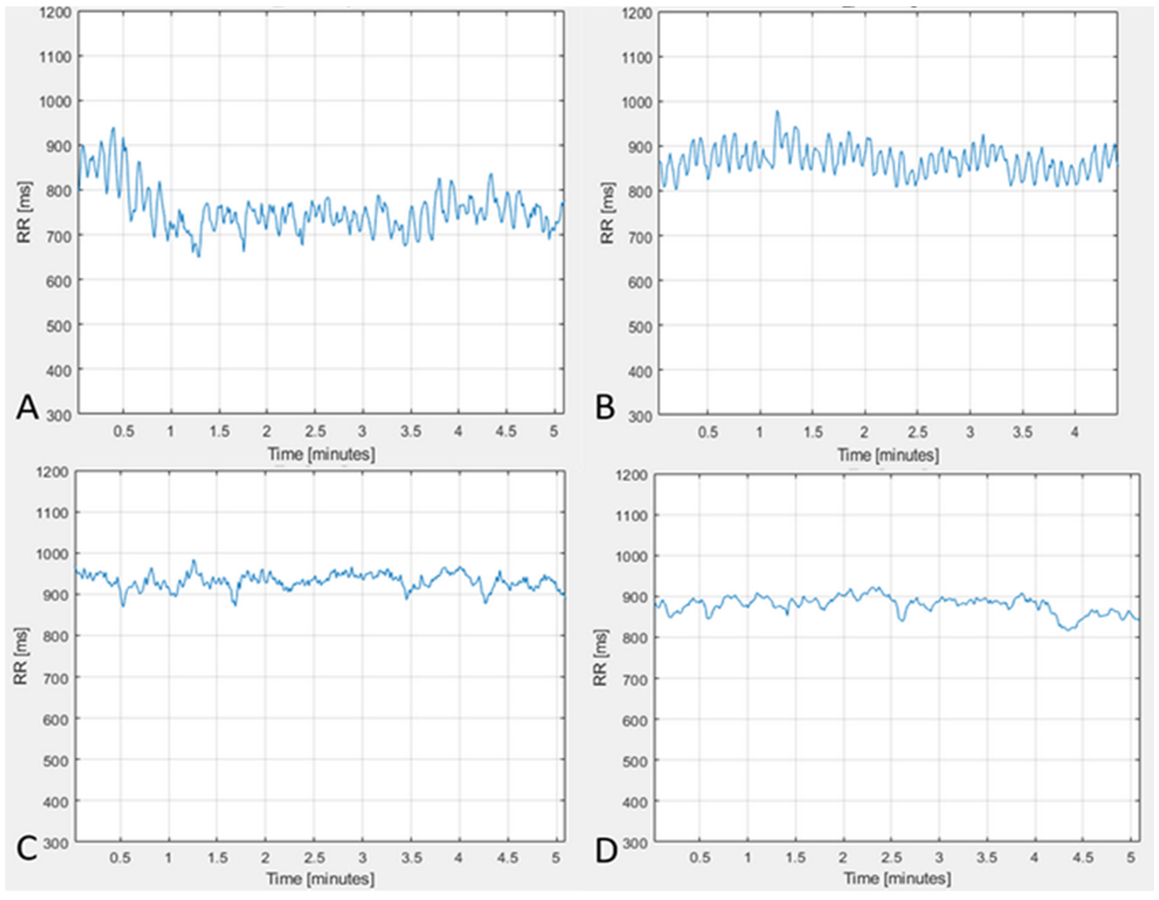 Entropy 25 01023 g004 Entropy 25 01023 g004