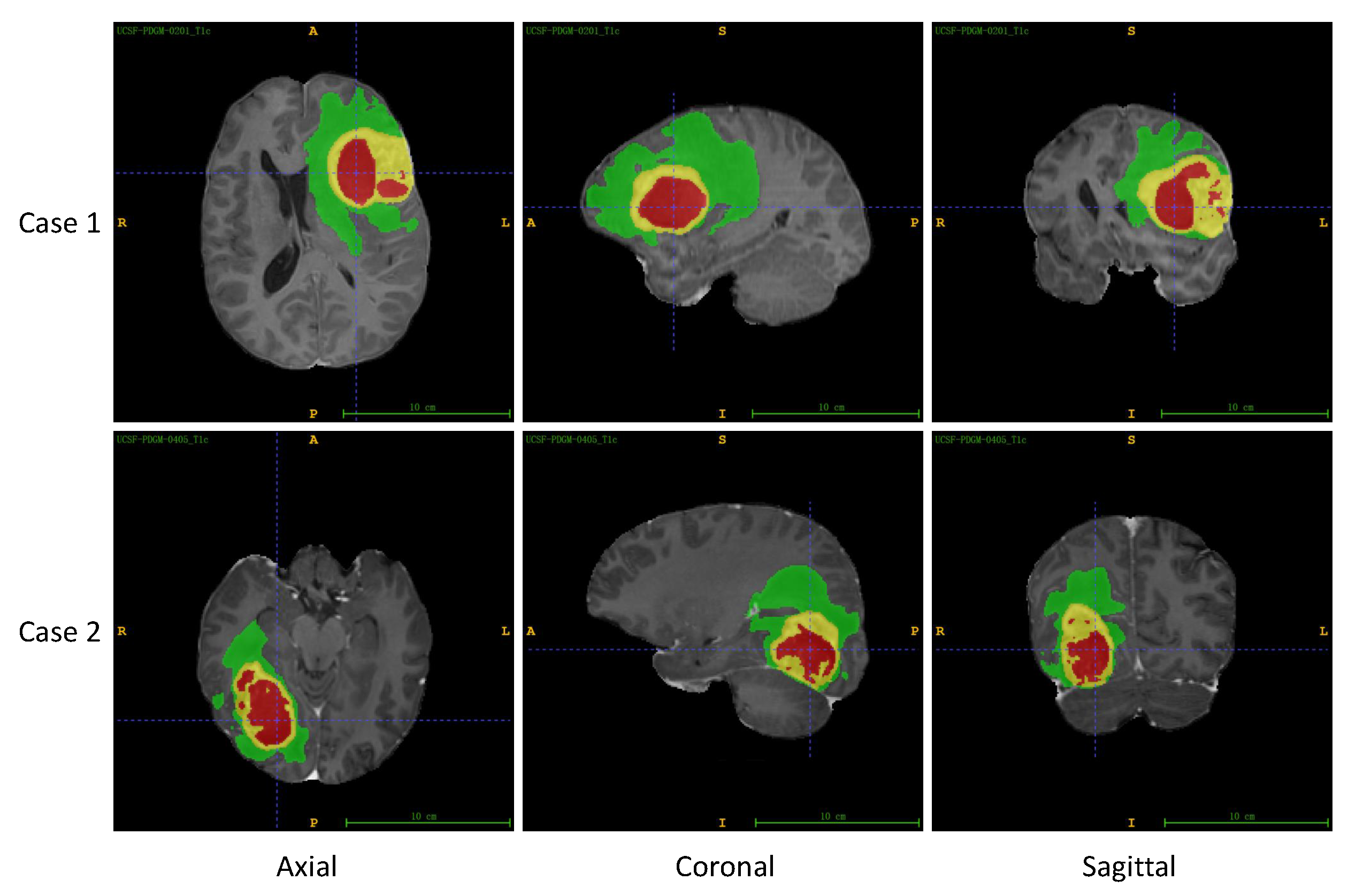 Entropy 26 00166 g005