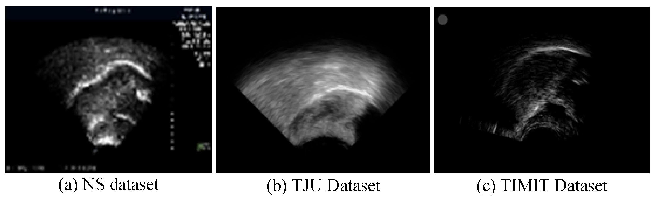 Entropy 26 00482 g006