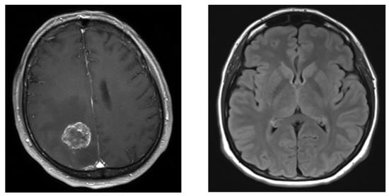 Entropy 26 00988 g005