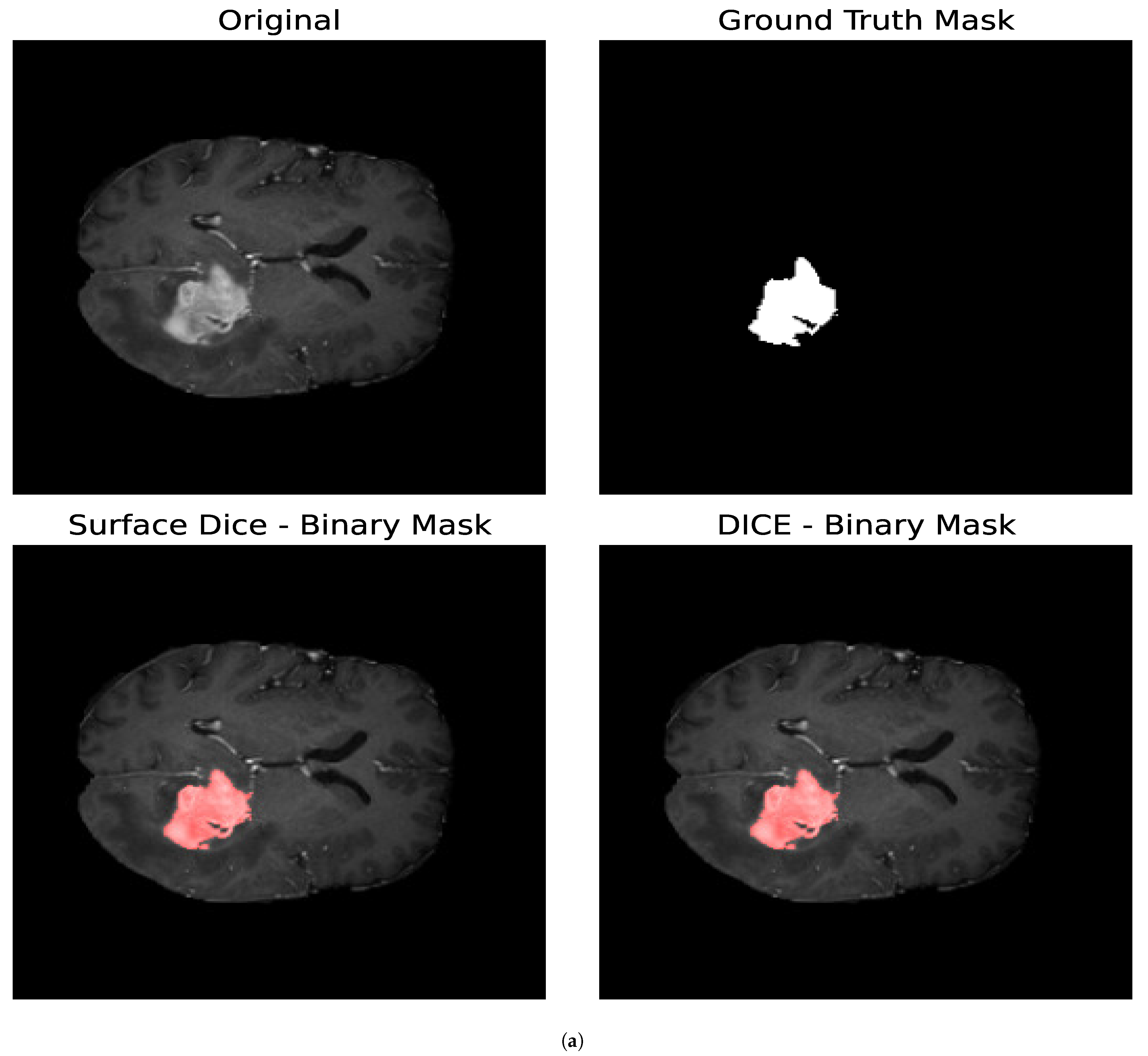 Entropy 27 00149 g010a