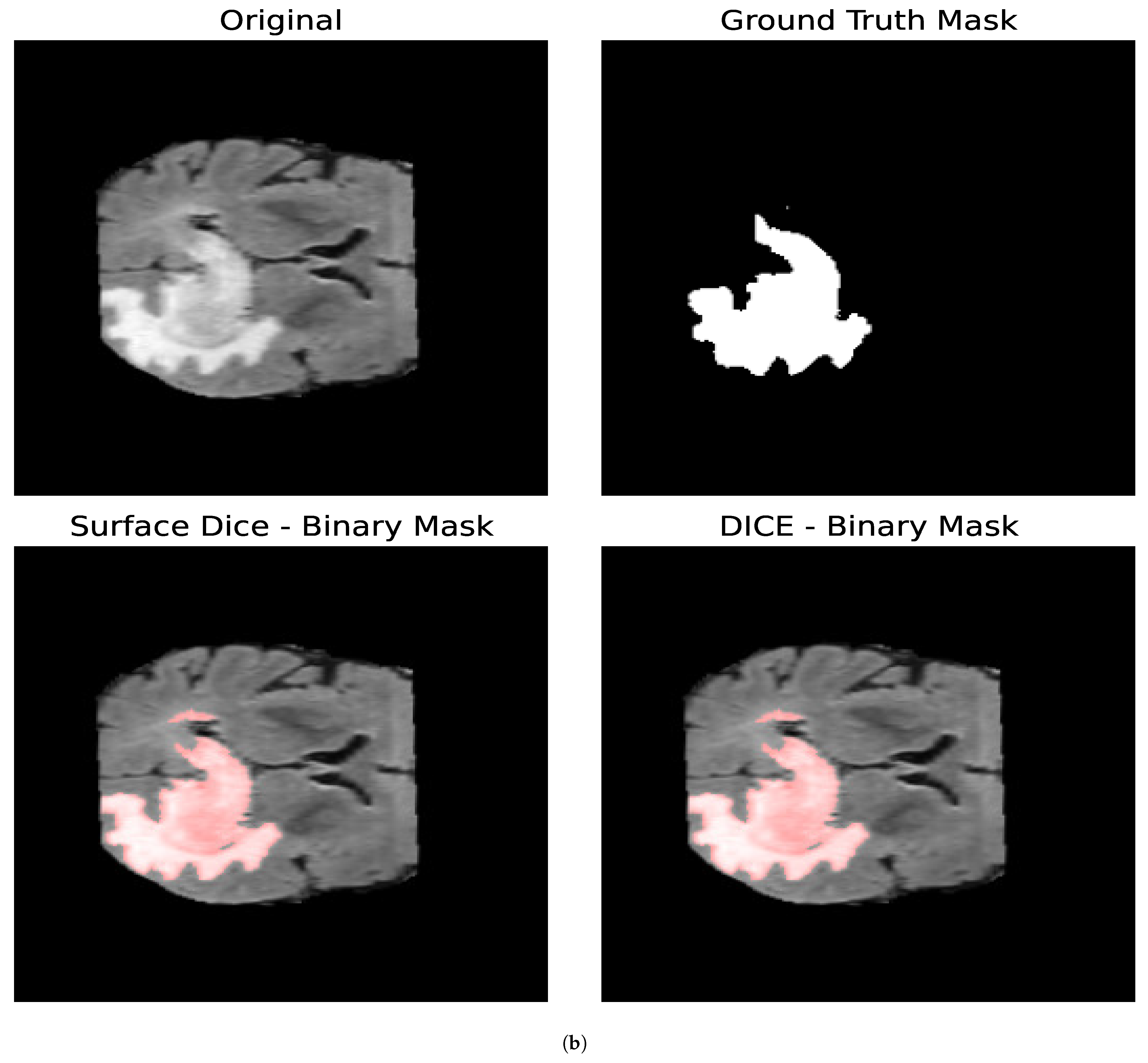 Entropy 27 00149 g010b