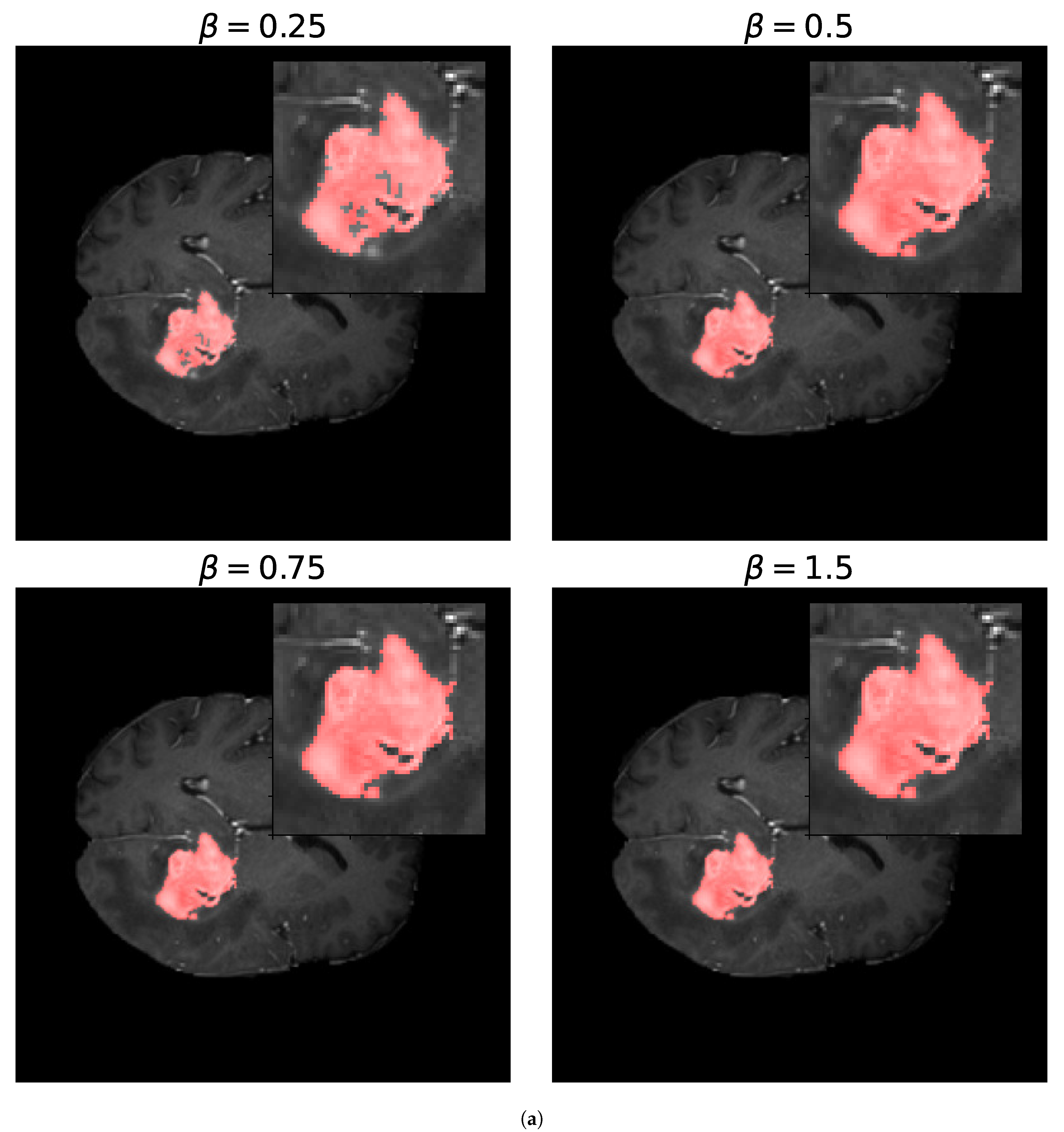Entropy 27 00149 g011a