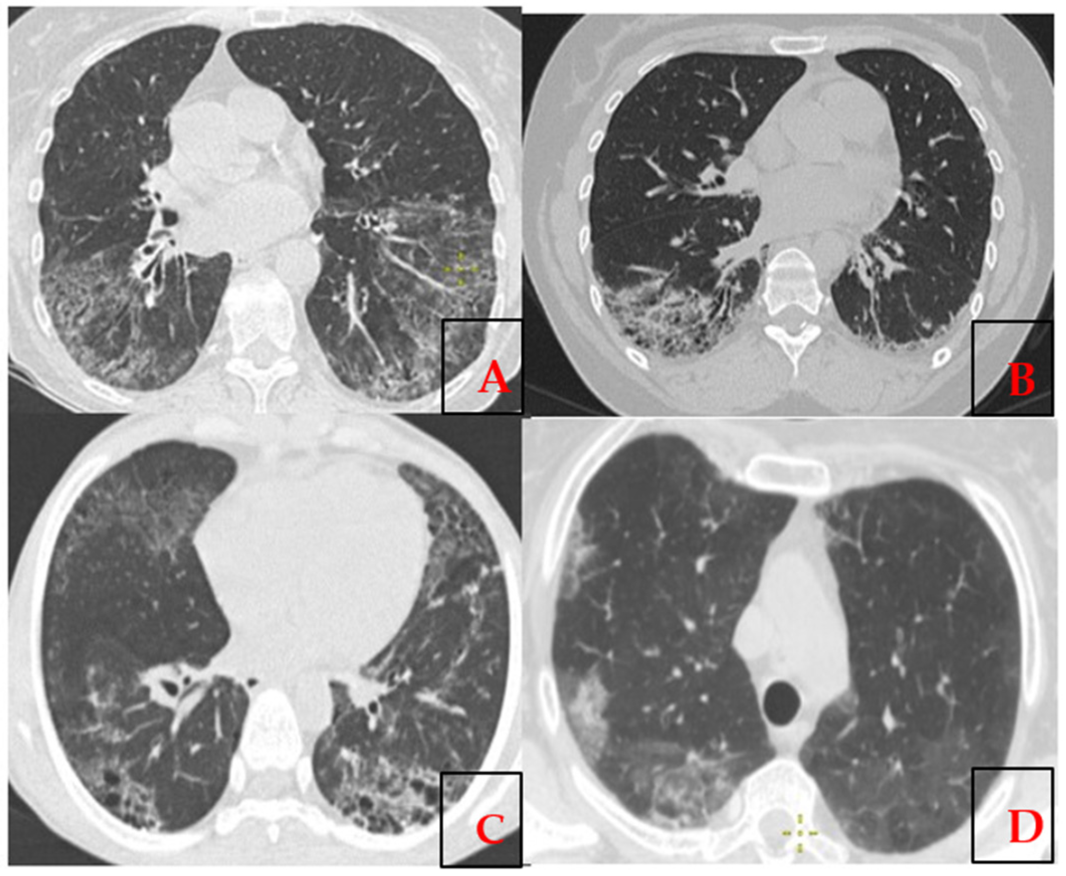 Epidemiologia 06 00041 g001 Epidemiologia 06 00041 g001