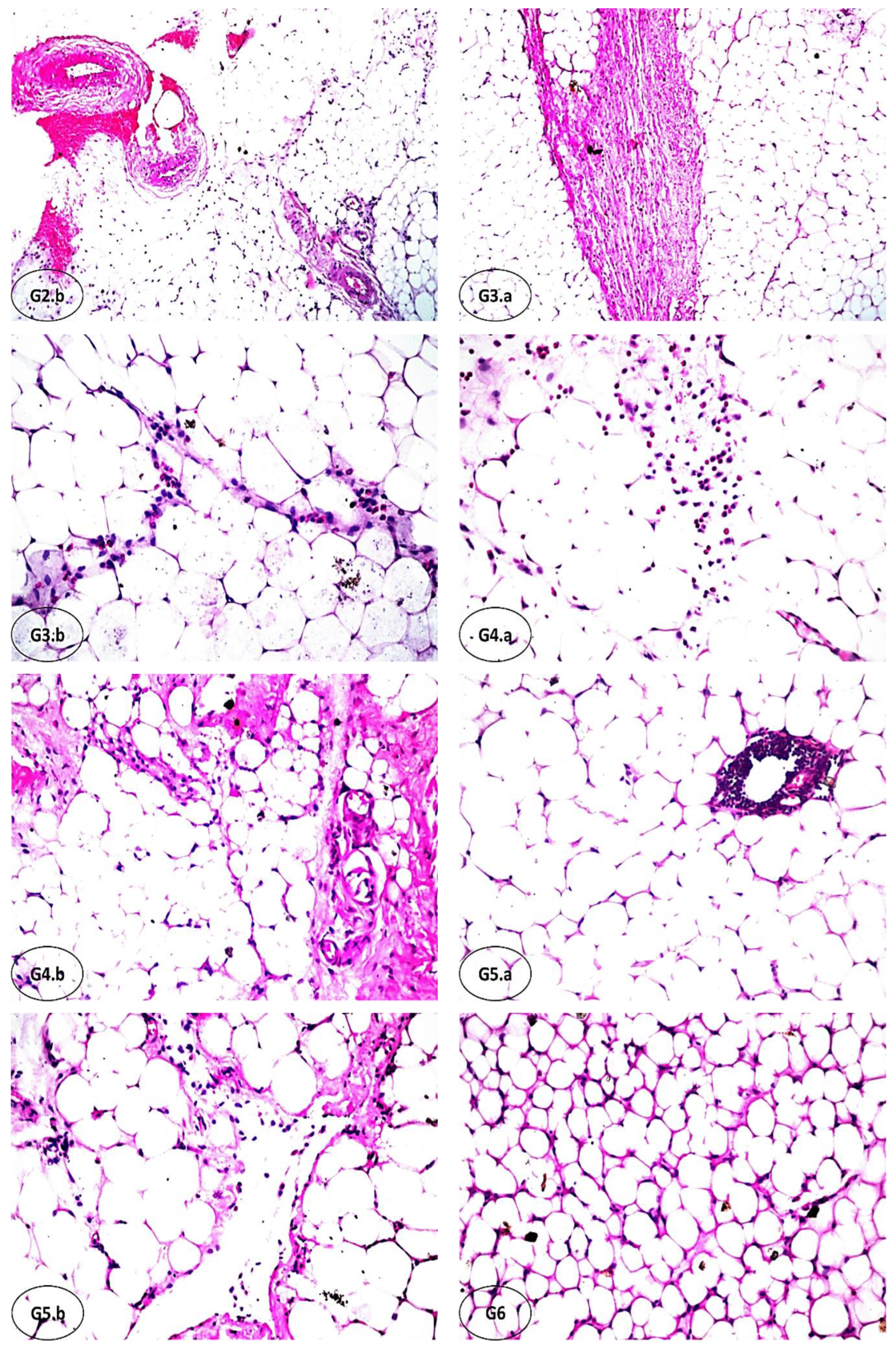 Fermentation 08 00619 g003b