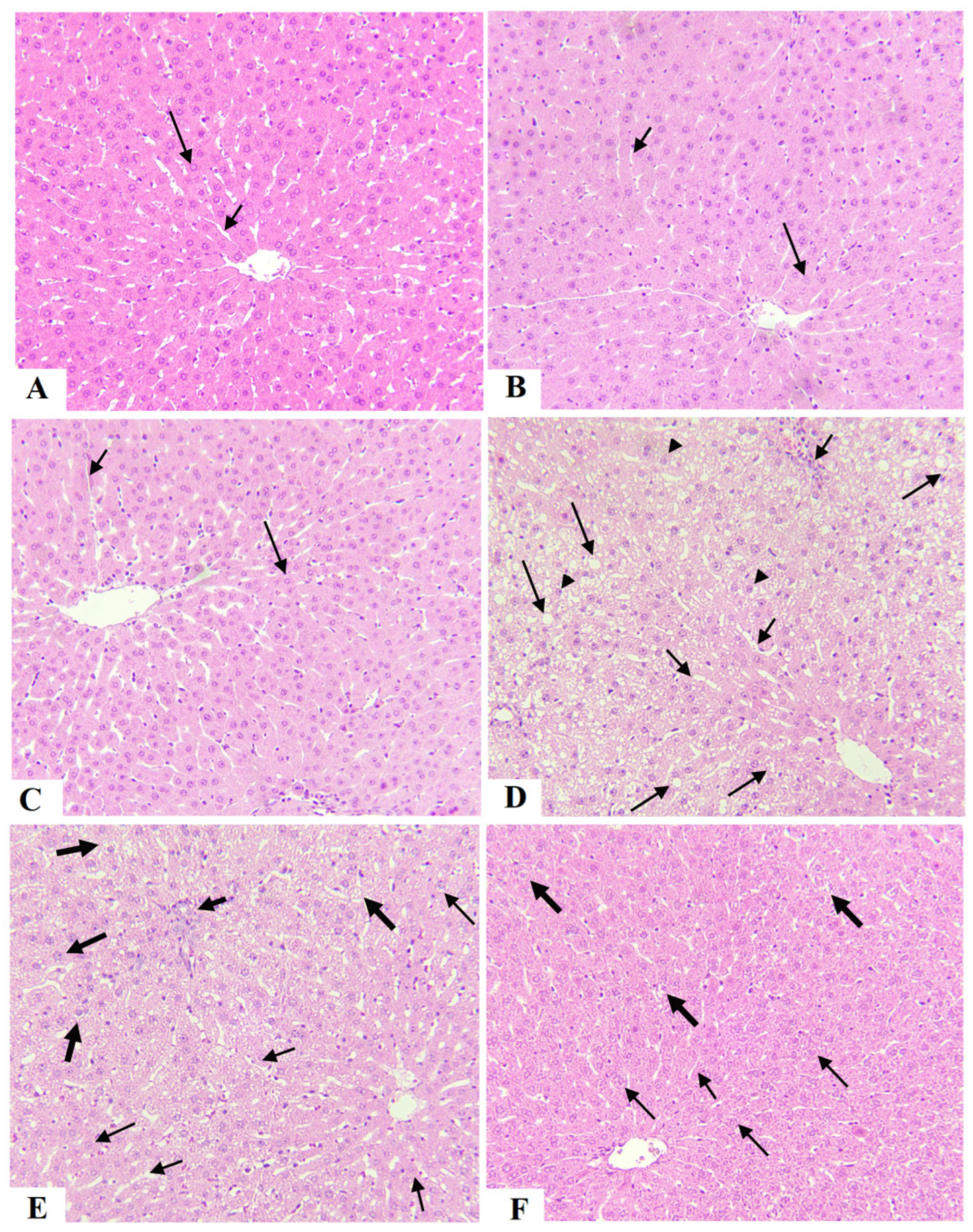 Fermentation 08 00735 g005