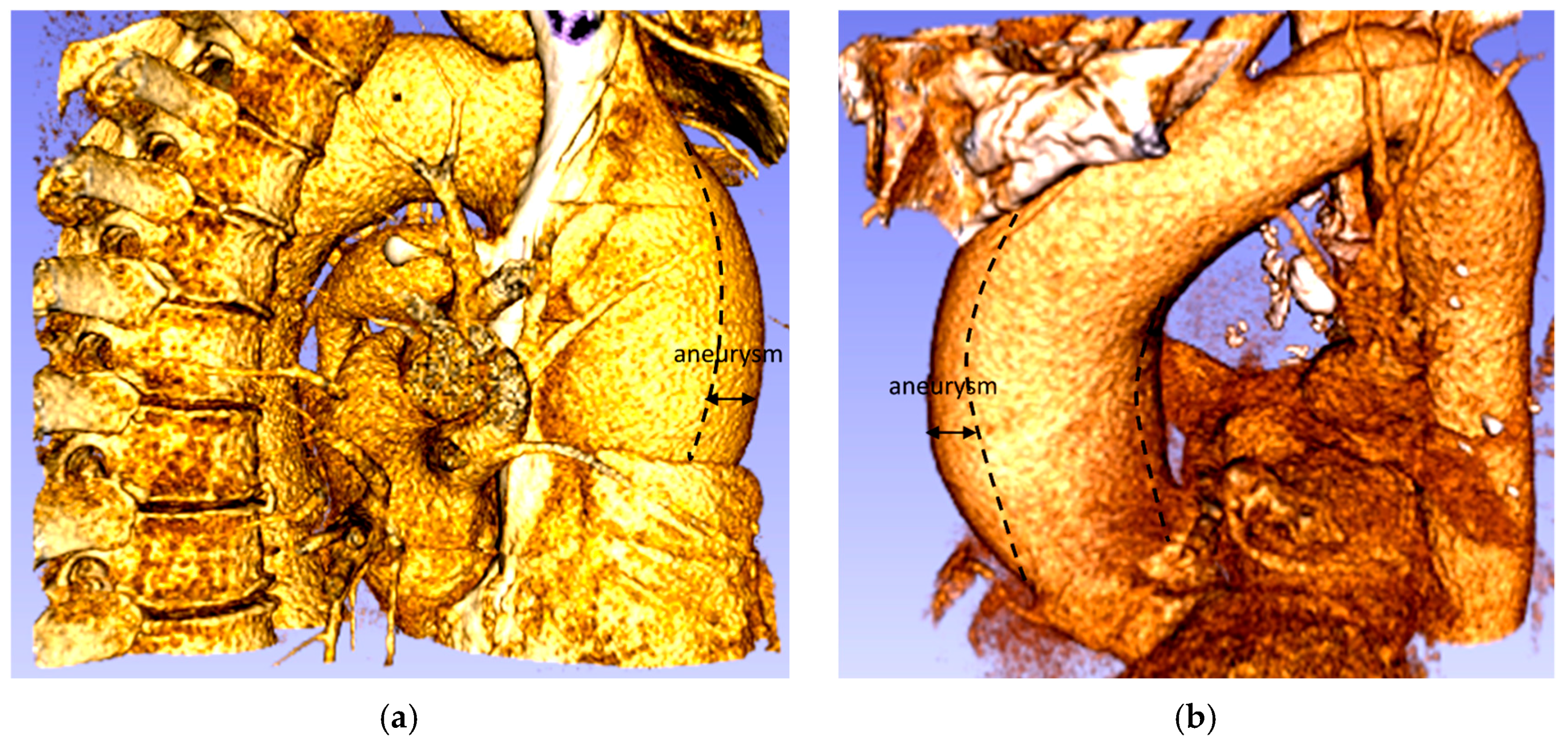 Fluids 02 00031 g002