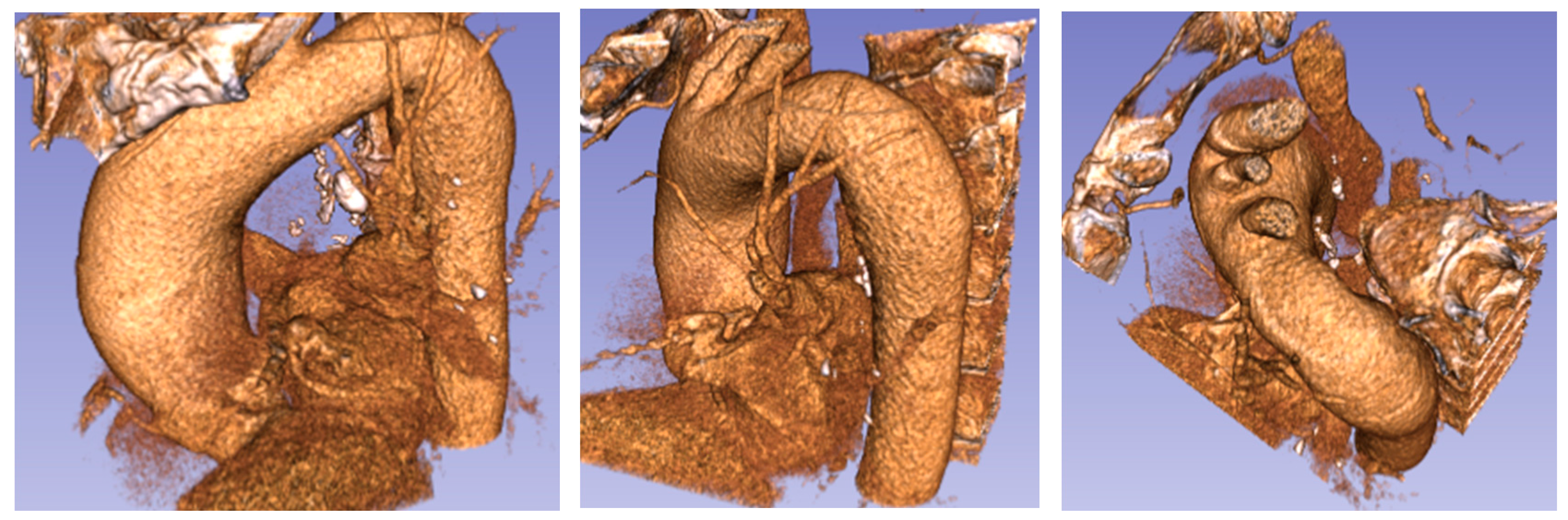 Fluids 02 00031 g004