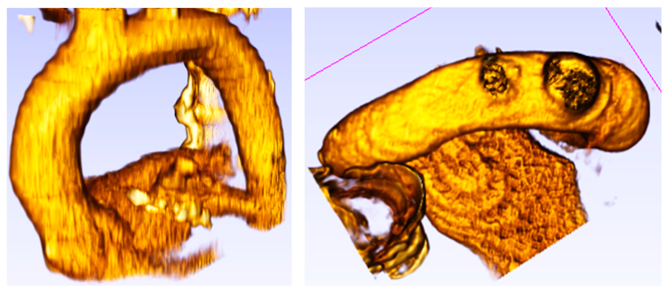 Fluids 02 00031 g005