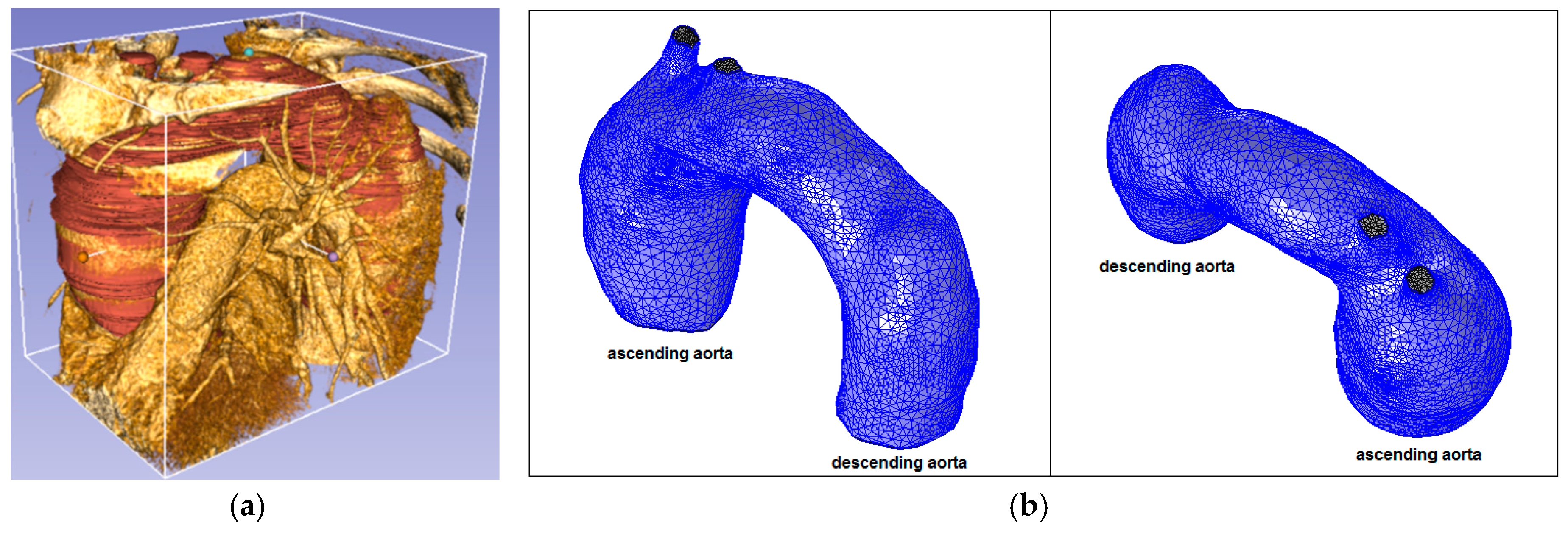 Fluids 02 00031 g006