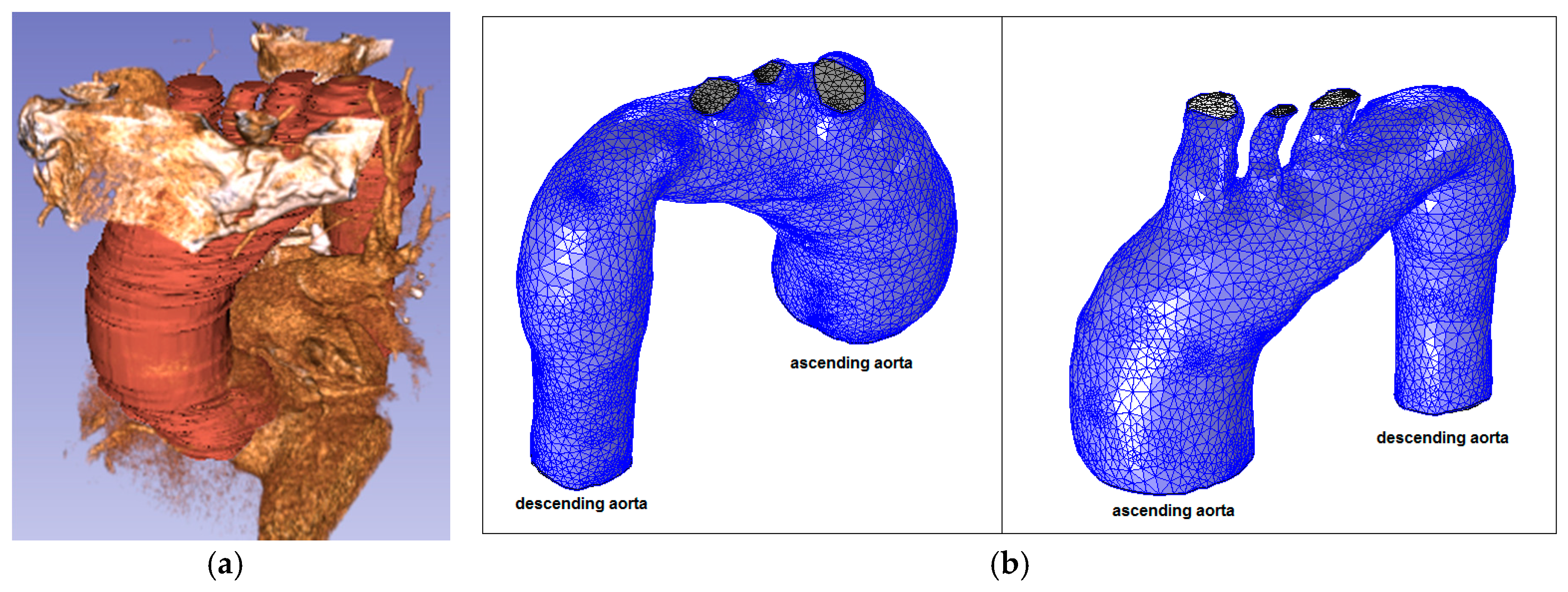 Fluids 02 00031 g007