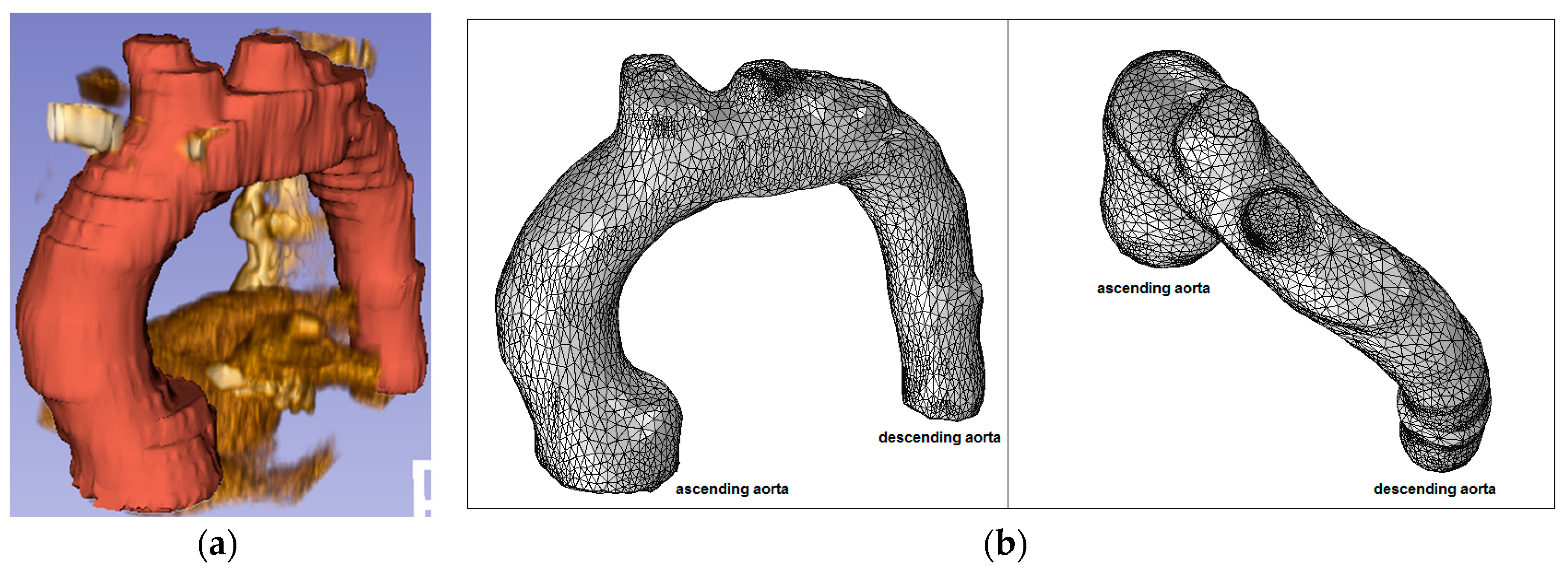Fluids 02 00031 g008