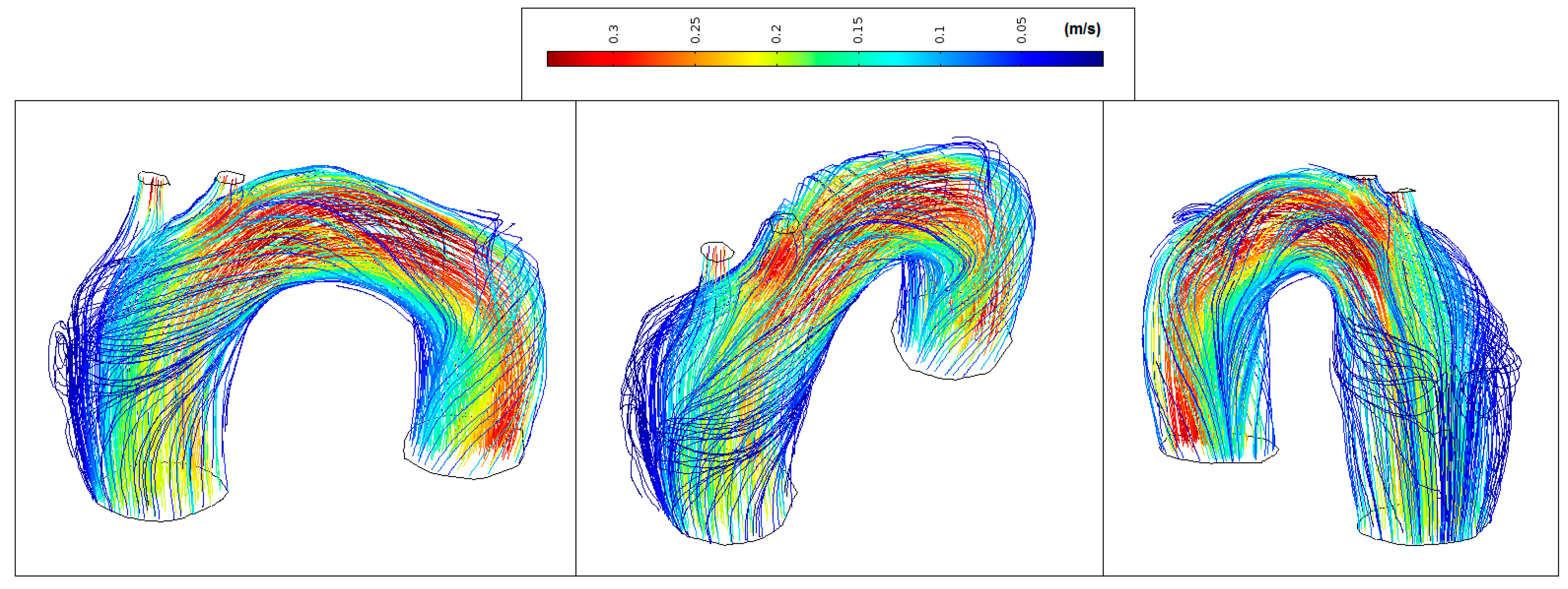 Fluids 02 00031 g012