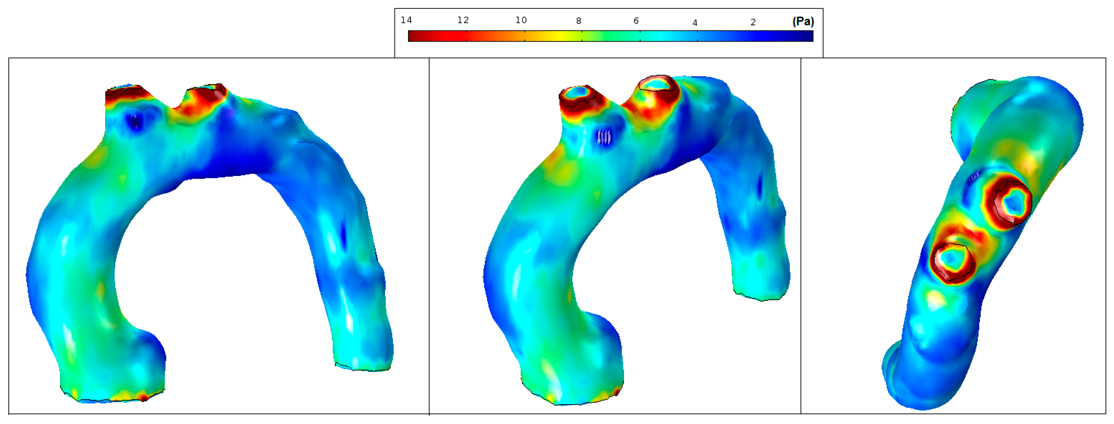 Fluids 02 00031 g014
