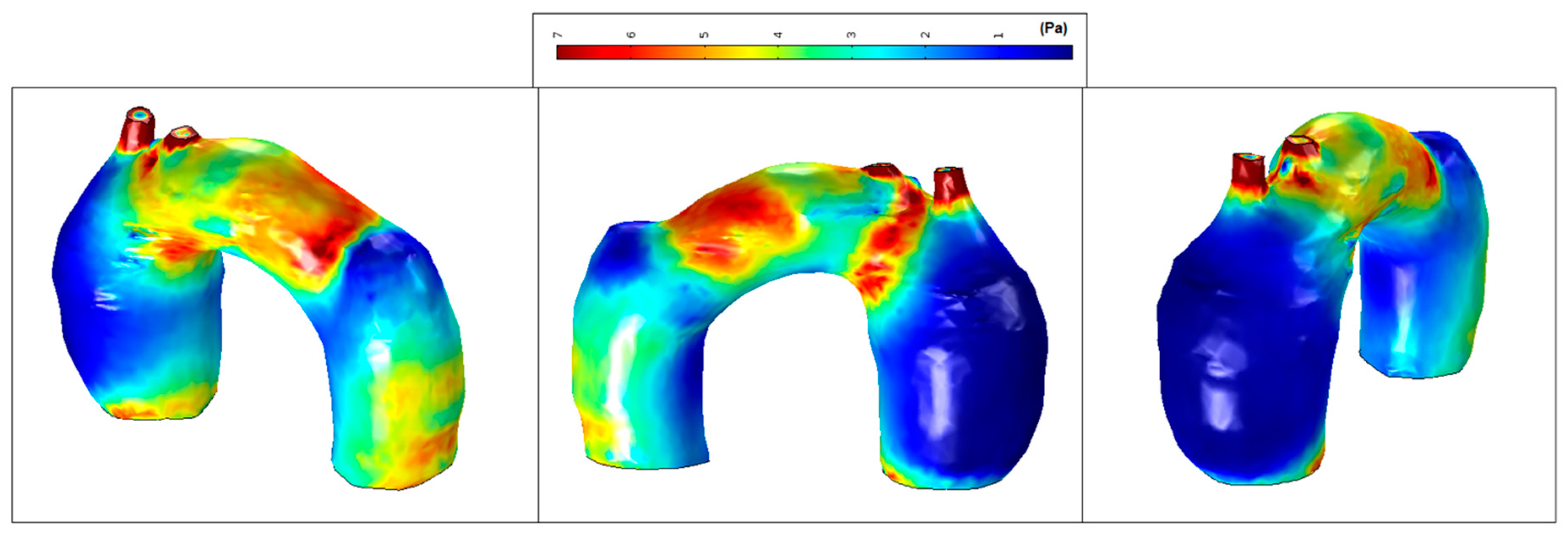 Fluids 02 00031 g015