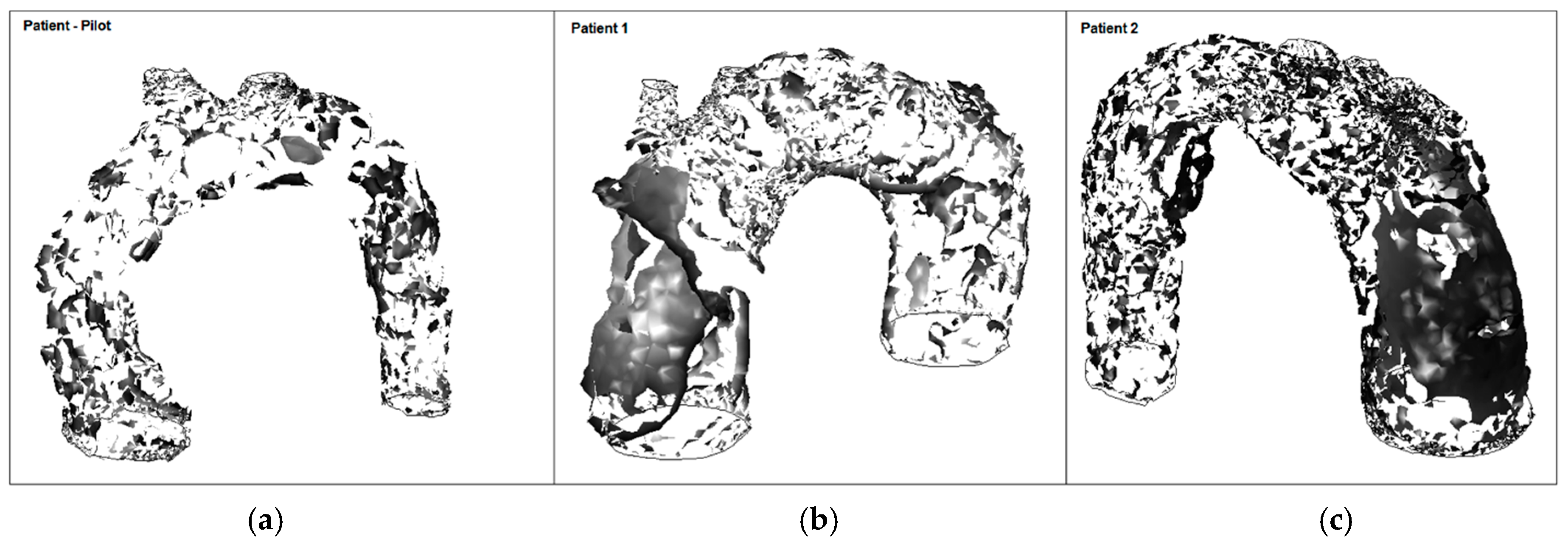 Fluids 02 00031 g018