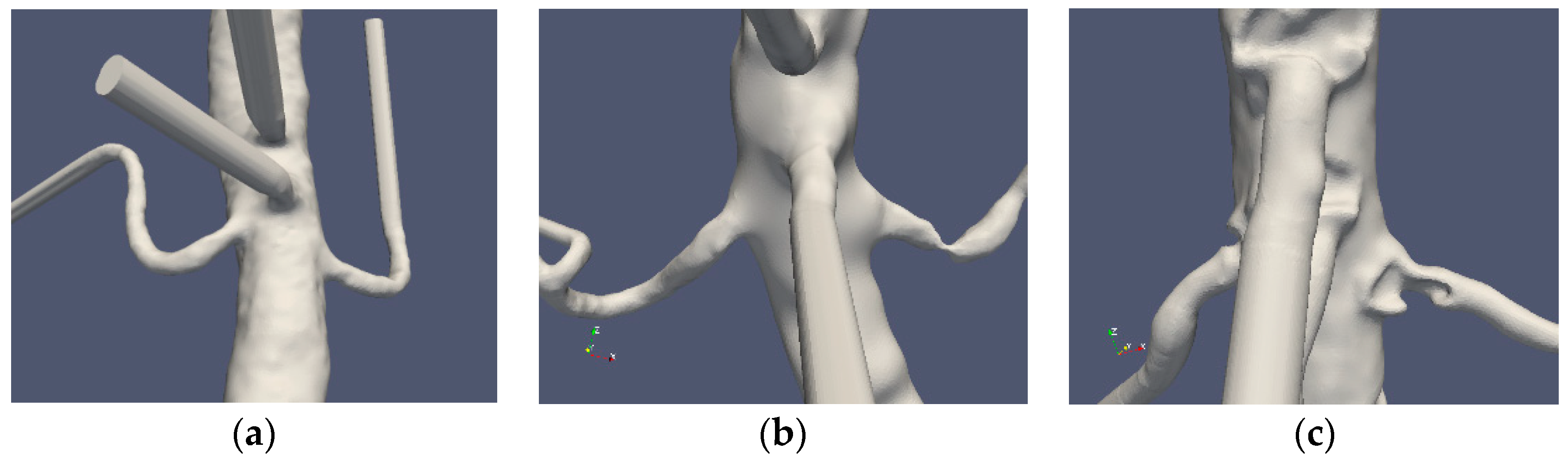 Fluids 04 00026 g001 Fluids 04 00026 g001