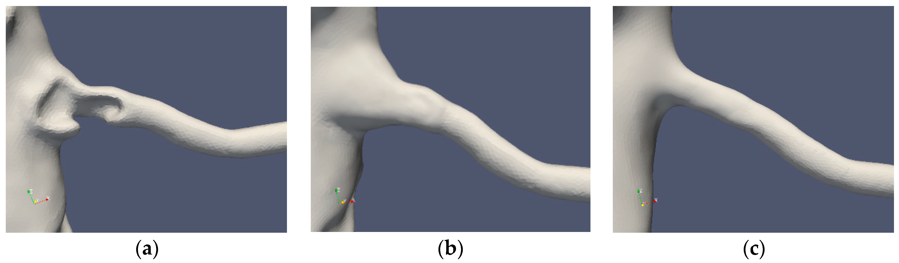 Fluids 04 00026 g003 Fluids 04 00026 g003