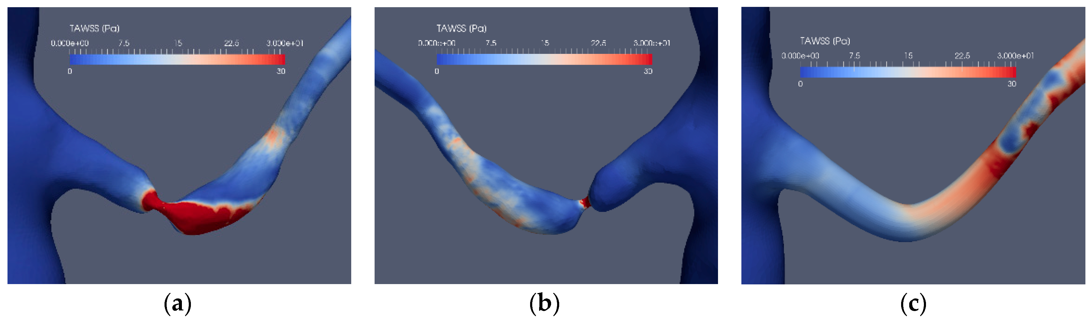 Fluids 04 00026 g009a Fluids 04 00026 g009a