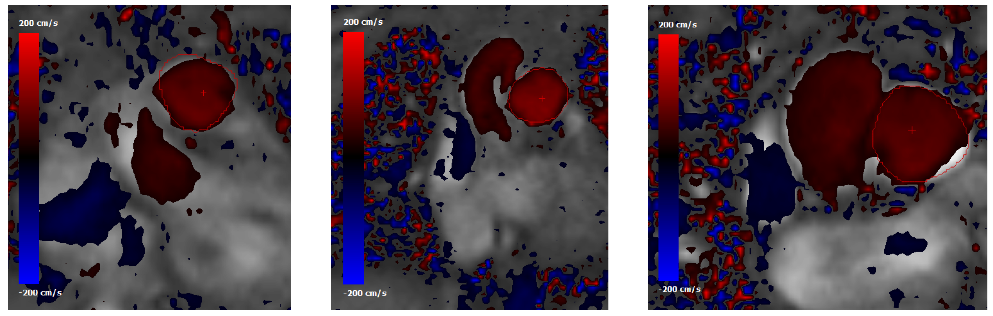 Fluids 04 00190 g006